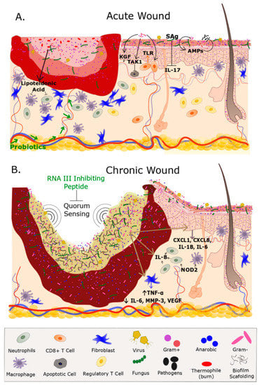 IJMS | Free Full-Text | The Cutaneous Microbiome and Wounds: New 