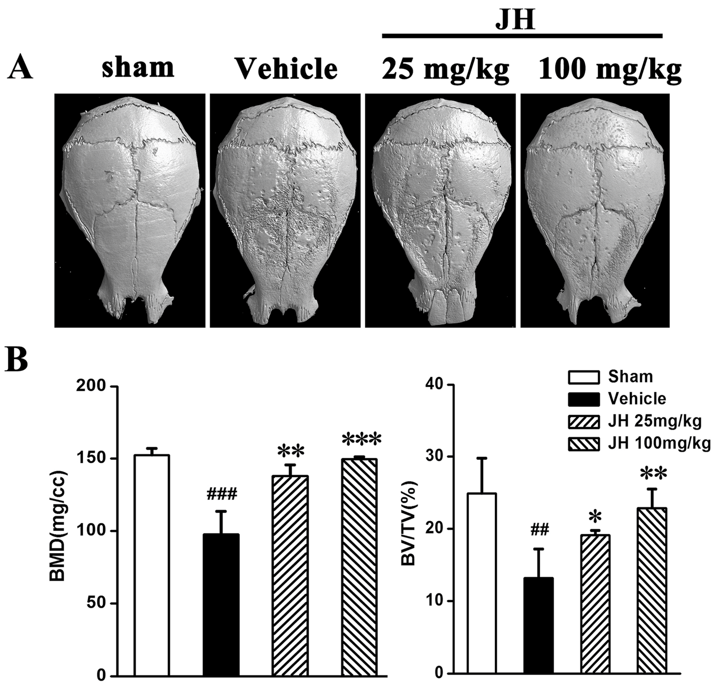 IJMS | Free Full-Text | Jatrorrhizine Hydrochloride Suppresses  RANKL-Induced Osteoclastogenesis and Protects against Wear Particle-Induced  Osteolysis