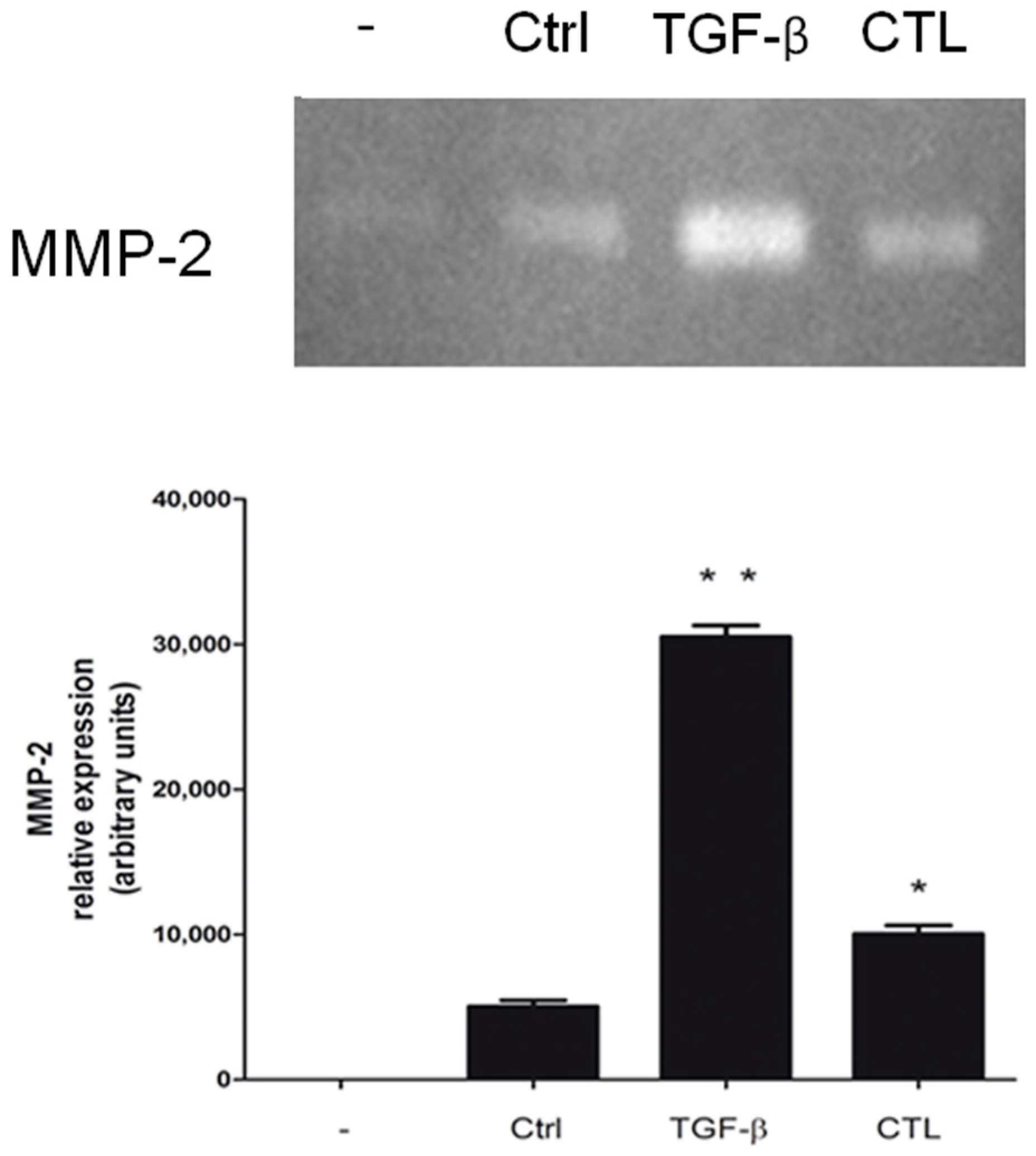 Ijms Free Full Text Epithelial To Mesenchymal Transition