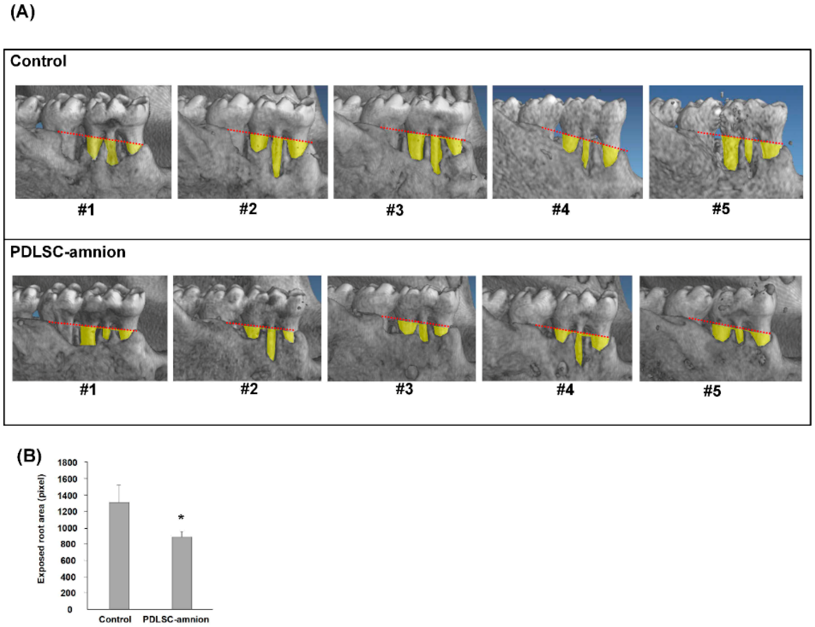 Ijms Free Full Text The Fate Of Transplanted Periodontal Ligament Stem Cells In Surgically Created Periodontal Defects In Rats Html