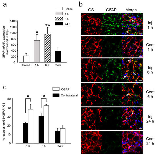 Ijms Free Full Text Cgrp Induces Differential Regulation Of