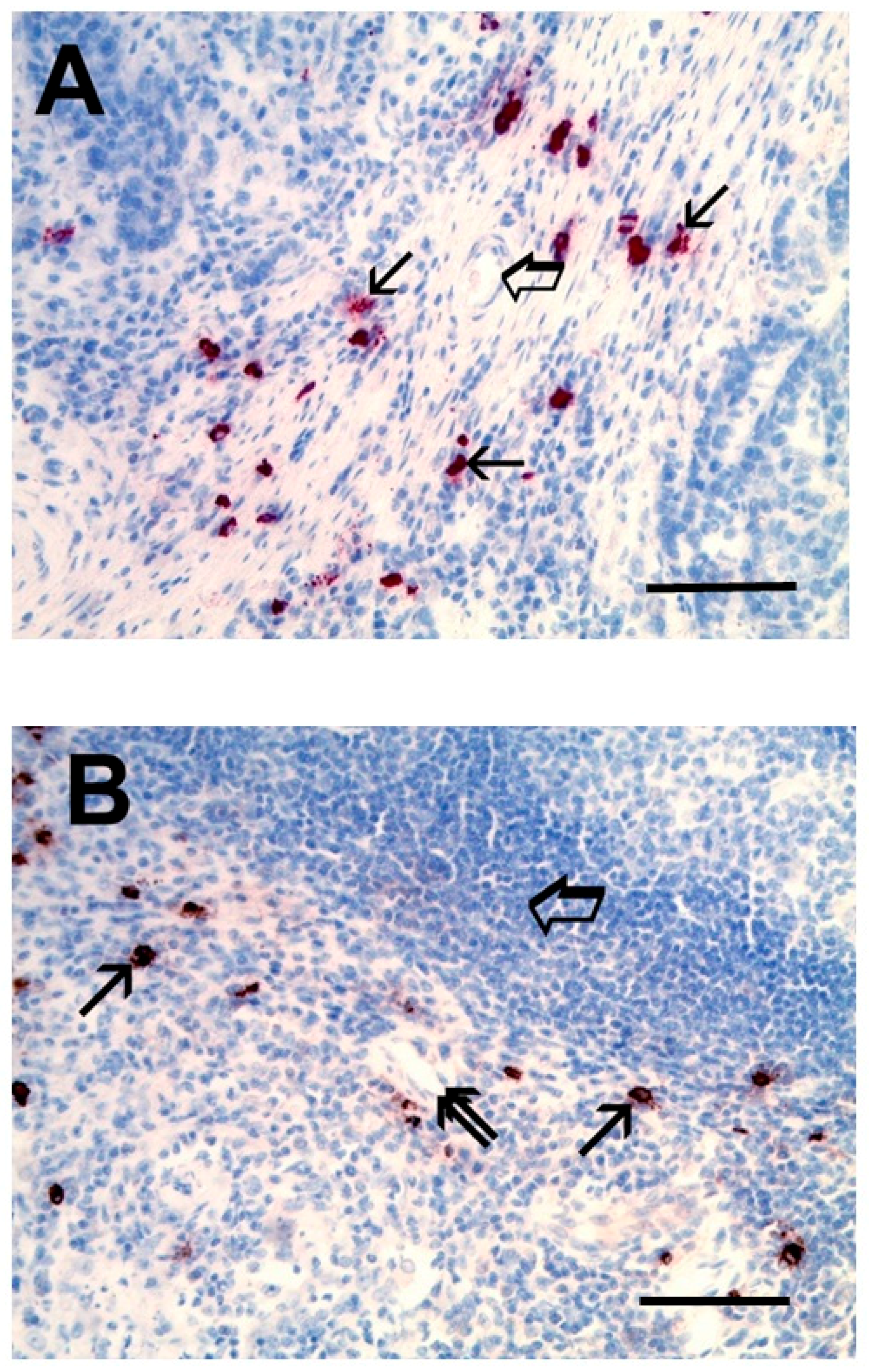 IJMS | Free Full-Text | Mast Cells, Angiogenesis and Lymphangiogenesis in  Human Gastric Cancer