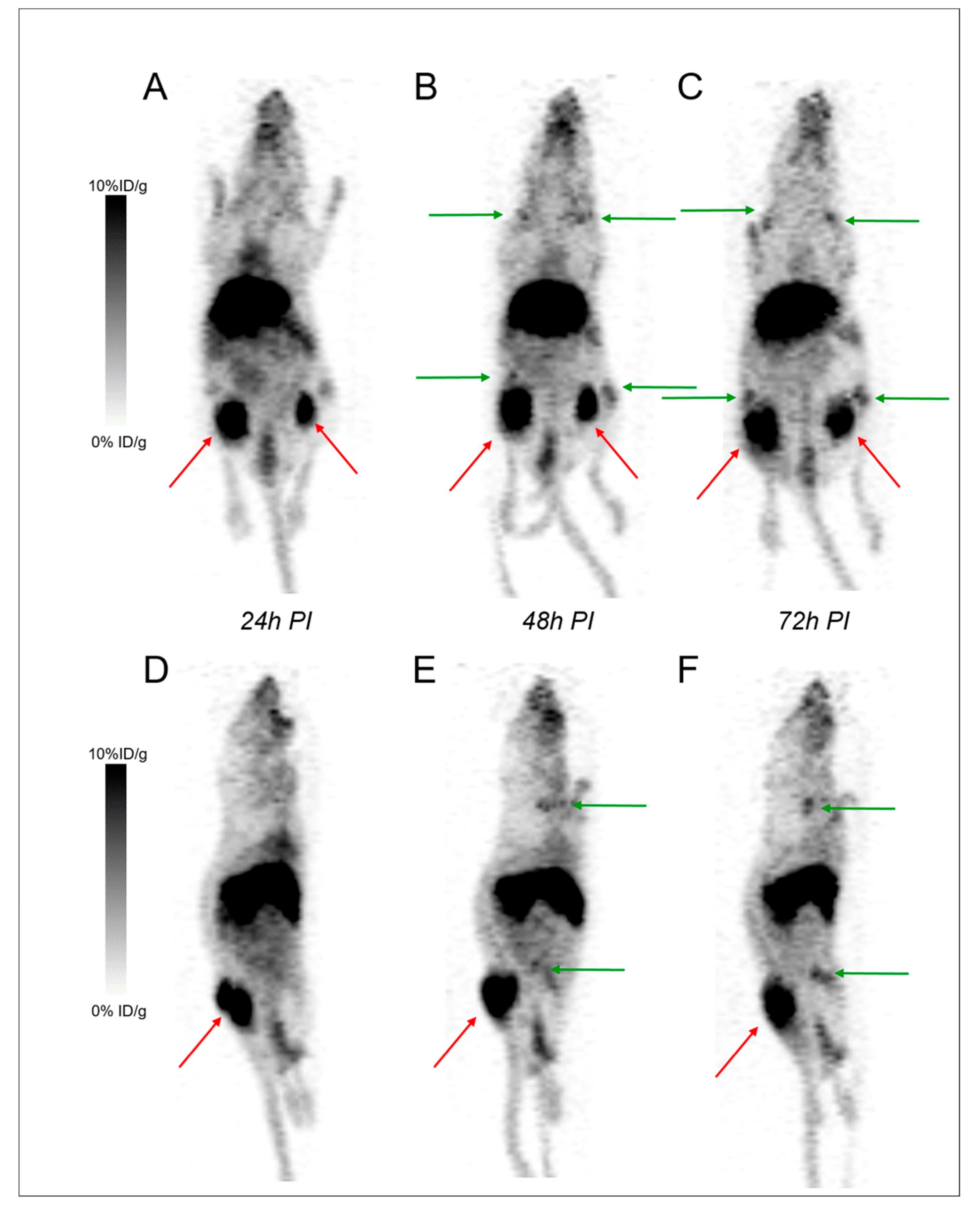 IJMS Free Full Text What is the Best Radionuclide for Immuno