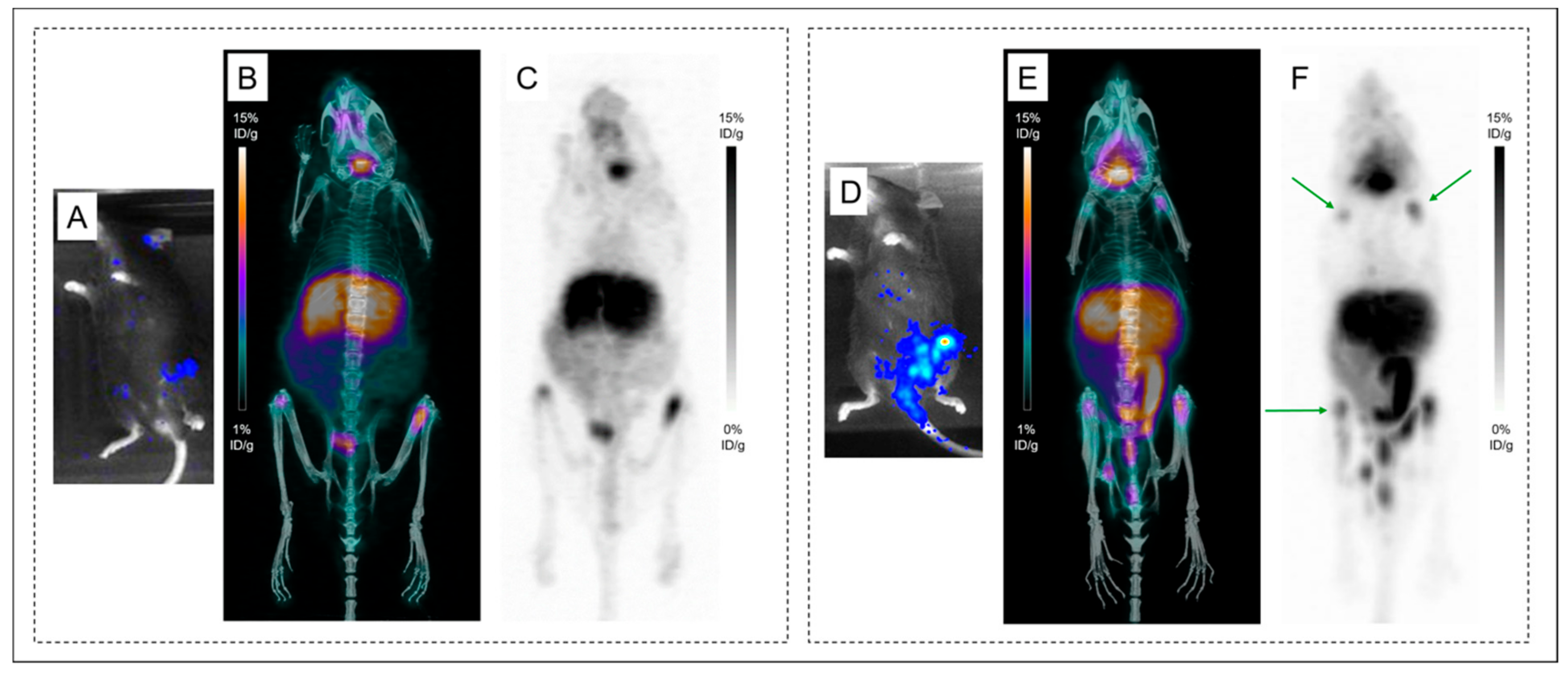 IJMS Free Full Text What is the Best Radionuclide for Immuno