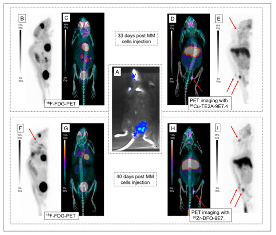 IJMS Free Full Text What is the Best Radionuclide for Immuno