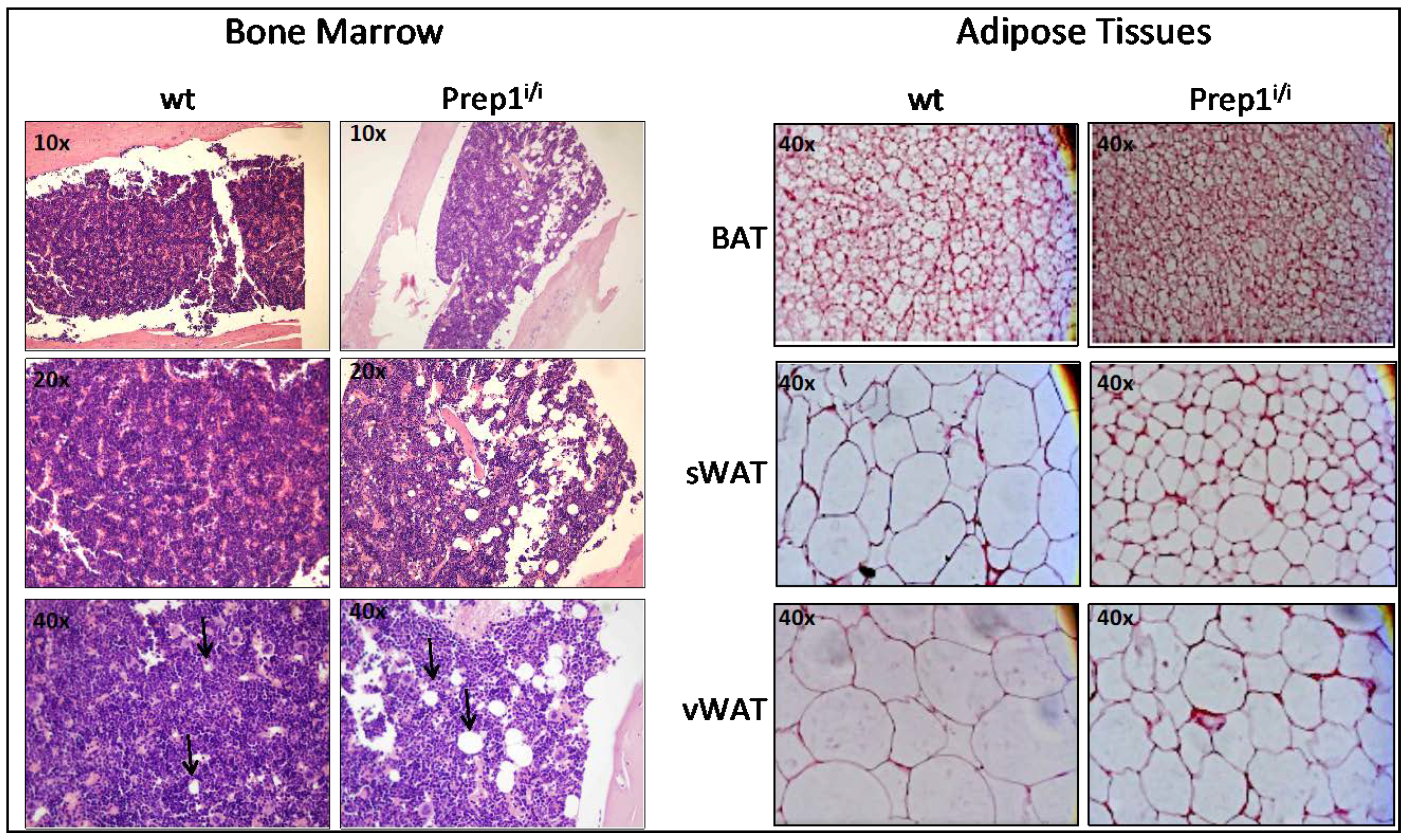 Adipose Tissue: Histology  Concise Medical Knowledge