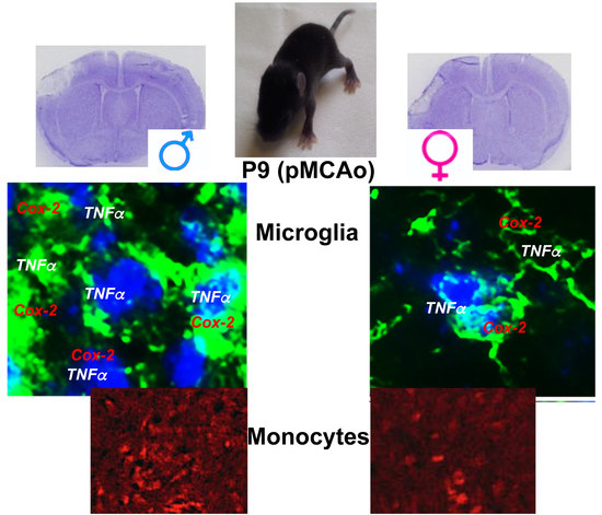 Ijms Free Full Text Early Sex Differences In The Immune