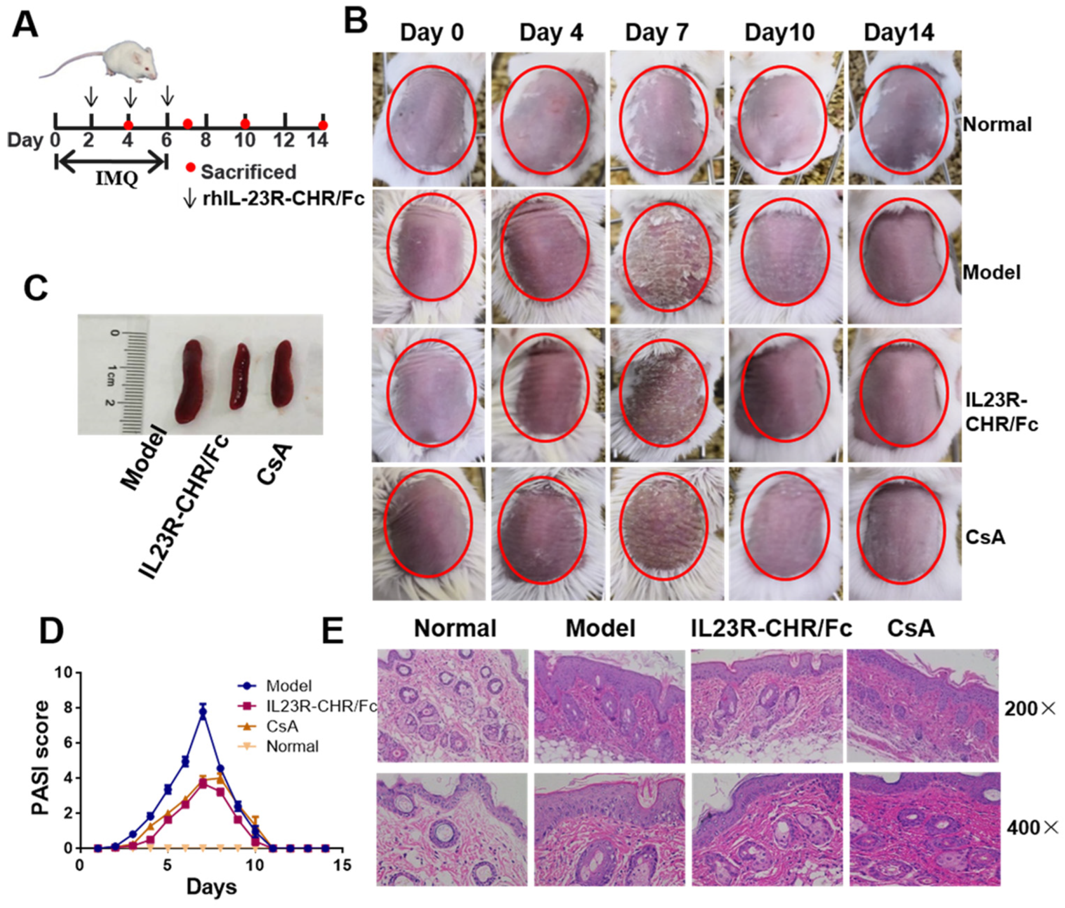 Ijms Free Full Text Human Il 23r Cytokine Binding Homology Region Fc Fusion Protein Ameliorates Psoriasis Via The Decrease Of Systemic Th17 And Ilc3 Cell Responses Html