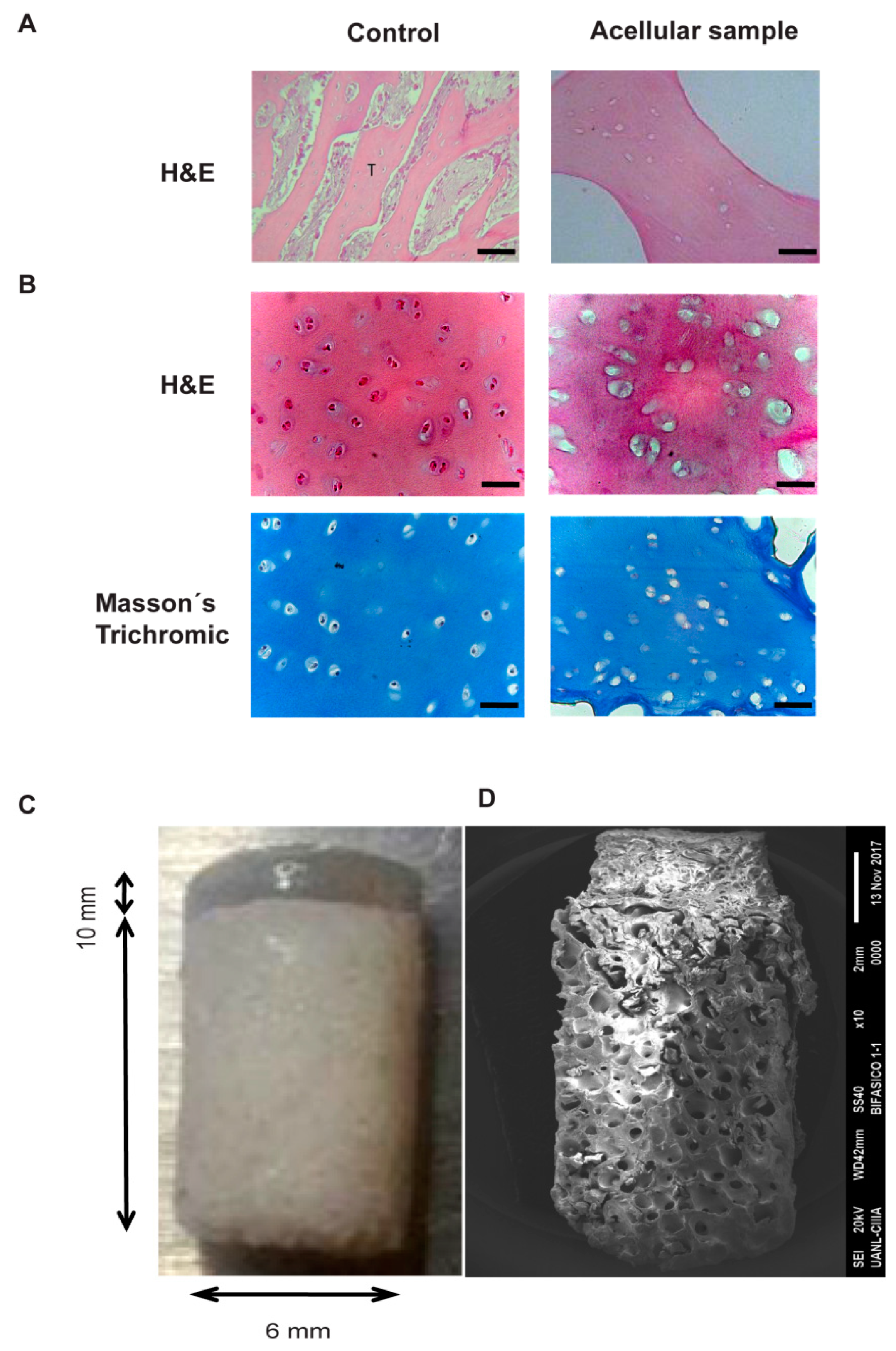 IJMS | Free Full-Text | A Cellularized Biphasic Implant Based on a  Bioactive Silk Fibroin Promotes Integration and Tissue Organization during  Osteochondral Defect Repair in a Porcine Model | HTML