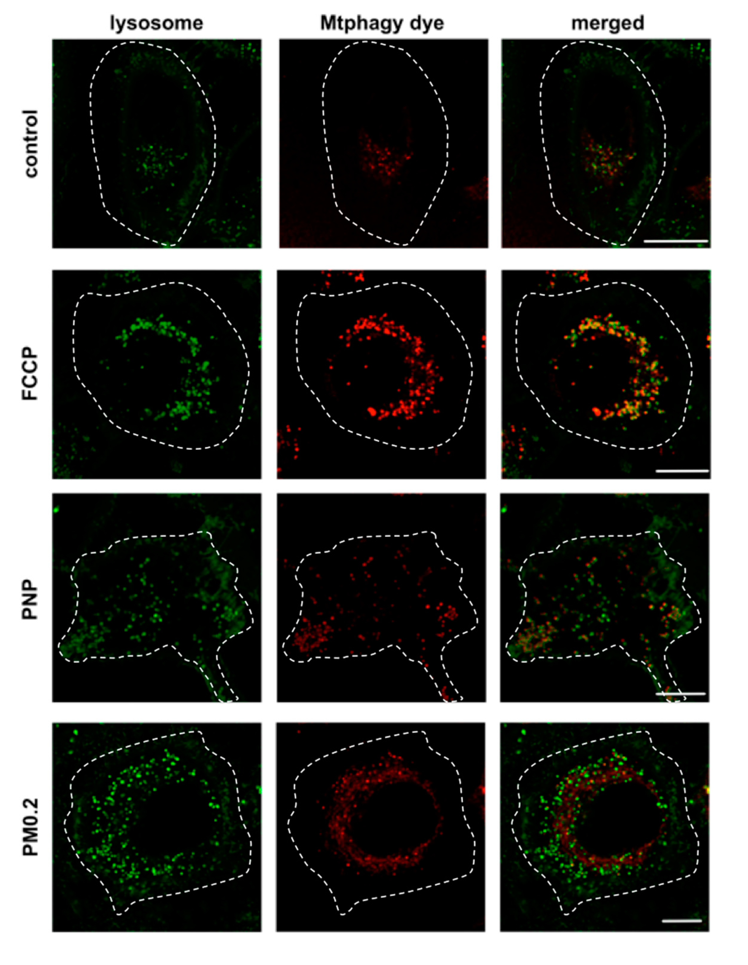 Ijms Free Full Text Evidence For Nanoparticle Induced Lysosomal Dysfunction In Lung Adenocarcinoma A549 Cells Html