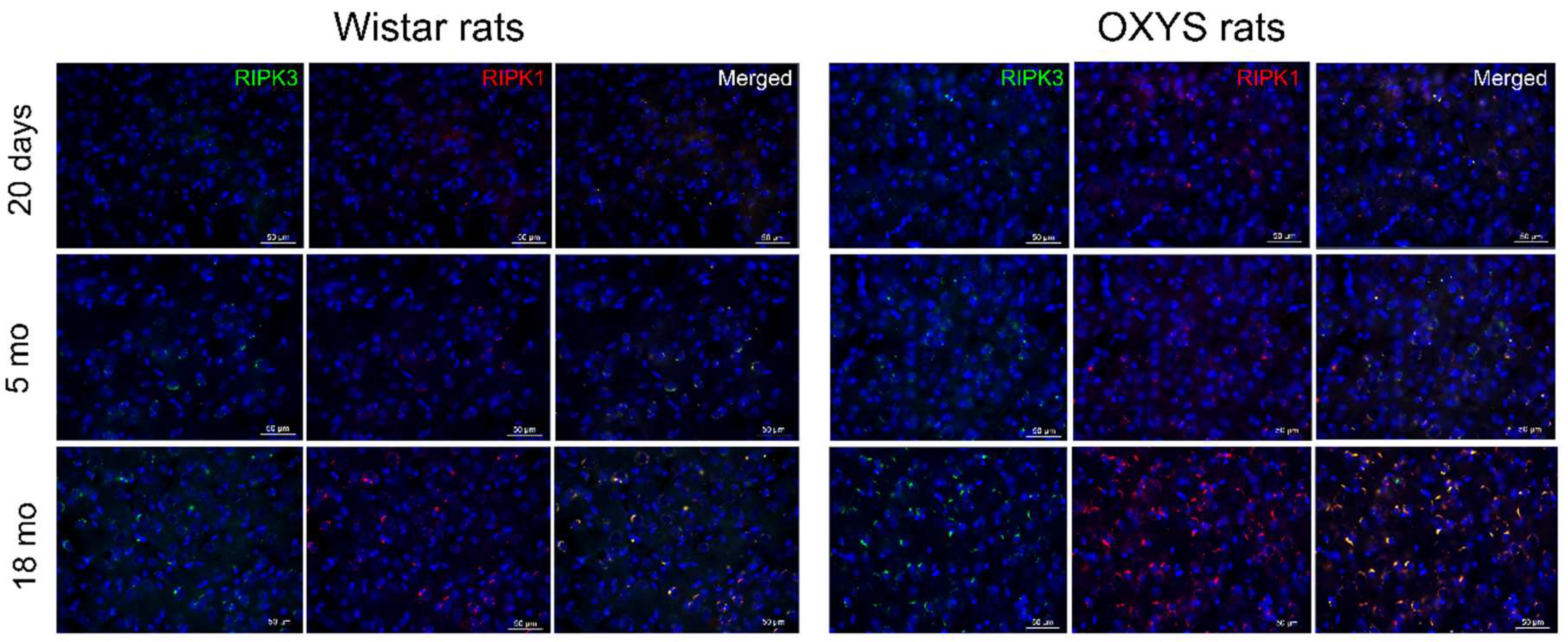 Ijms 20 05632 g004 Ijms 20 05632 g004