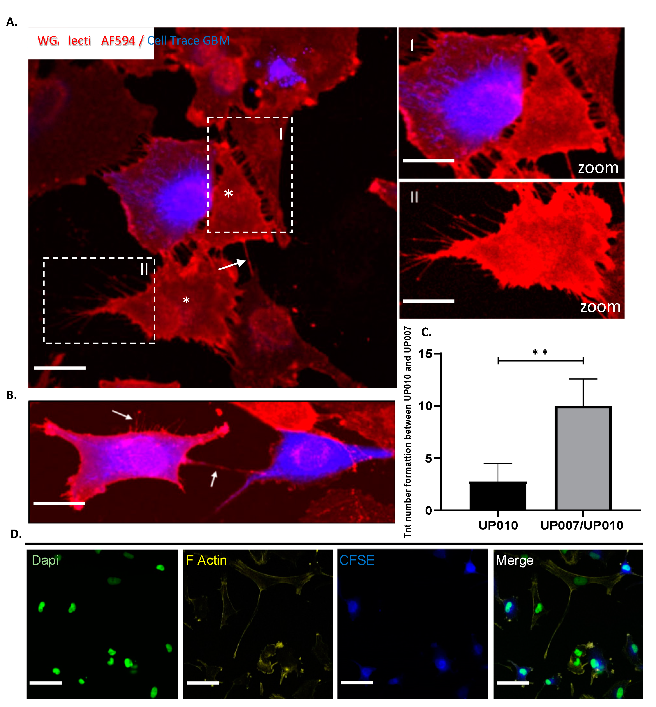 Ijms Free Full Text Pre Clinical Drug Testing In 2d And 3d Human In Vitro Models Of Glioblastoma Incorporating Non Neoplastic Astrocytes Tunneling Nano Tubules And Mitochondrial Transfer Modulates Cell Behavior And Therapeutic