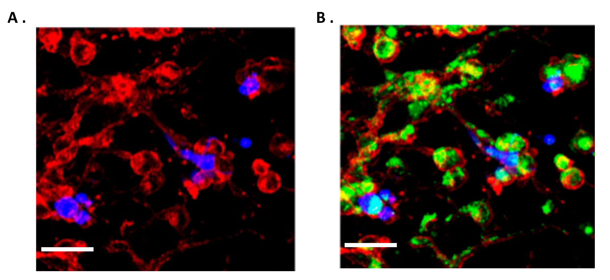 Ijms Free Full Text Pre Clinical Drug Testing In 2d And 3d Human In Vitro Models Of Glioblastoma Incorporating Non Neoplastic Astrocytes Tunneling Nano Tubules And Mitochondrial Transfer Modulates Cell Behavior And Therapeutic