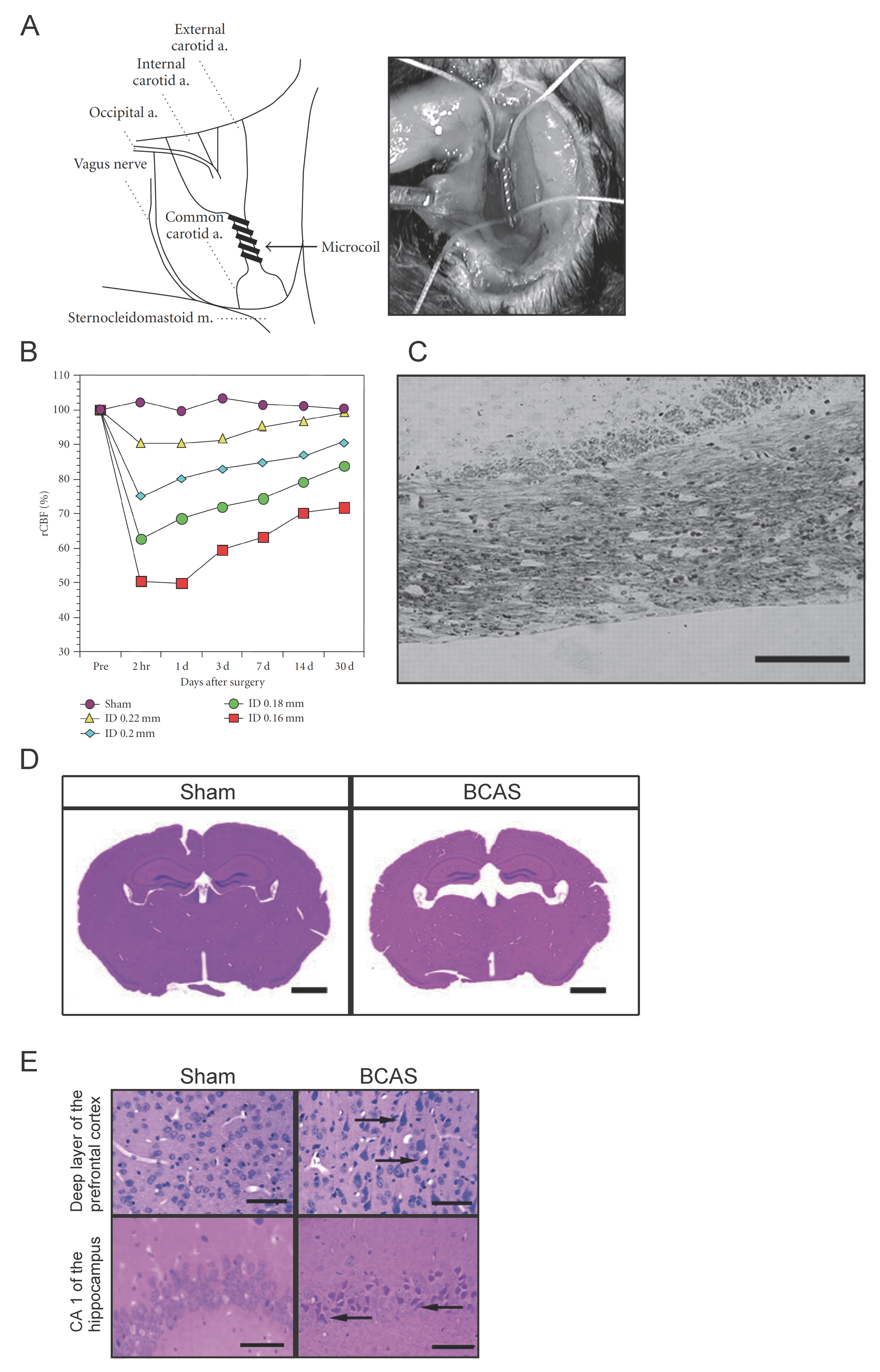 Ijms Free Full Text Animal Models Of Chronic Cerebral Hypoperfusion From Mouse To Primate Html