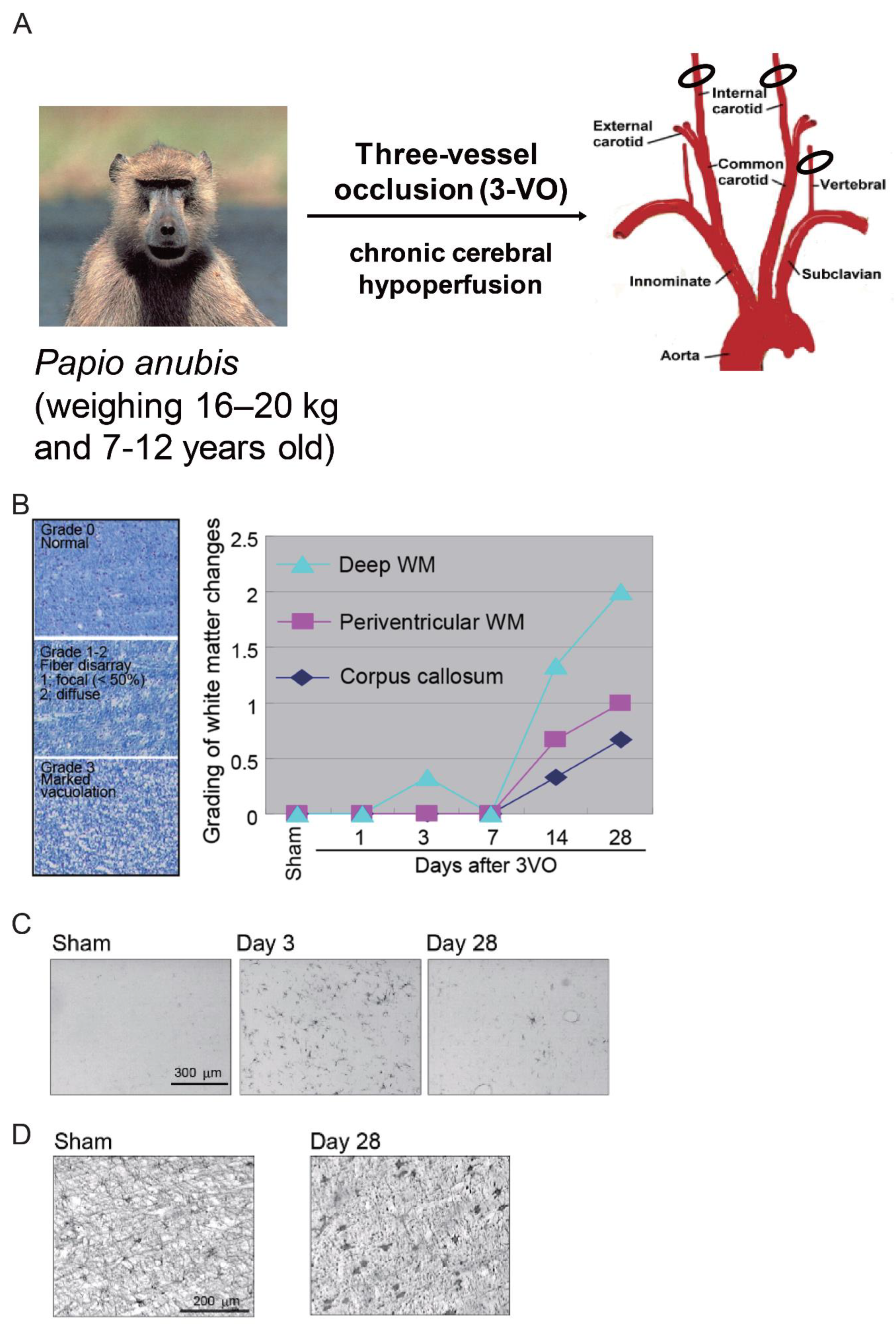 Ijms Free Full Text Animal Models Of Chronic Cerebral Hypoperfusion From Mouse To Primate Html