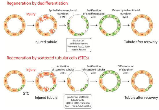 Ijms Special Issue Kidney Inflammation Injury And Regeneration