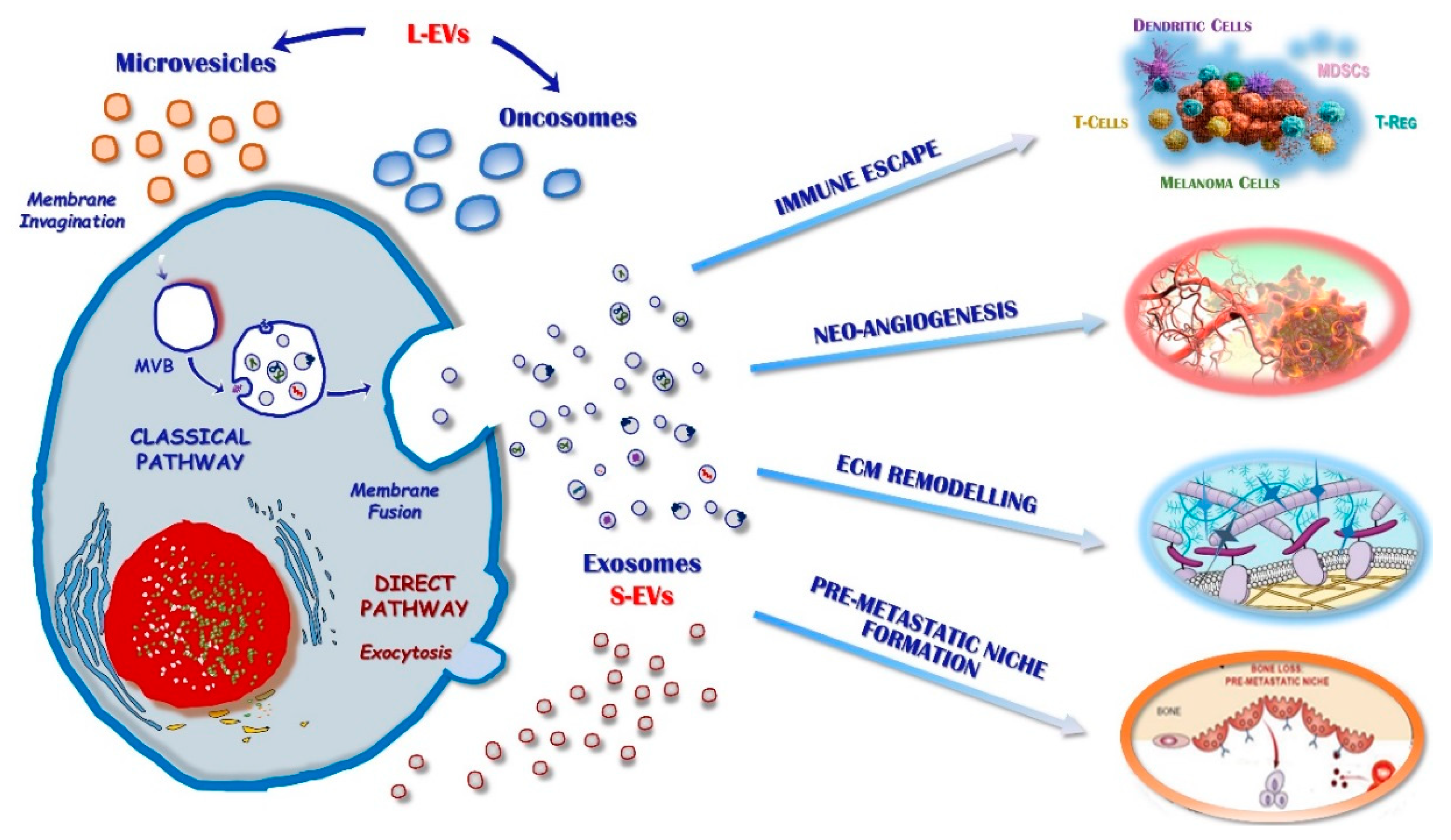 IJMS | Free Full-Text | Extracellular Vesicles and Epigenetic Modifications  Are Hallmarks of Melanoma Progression | HTML