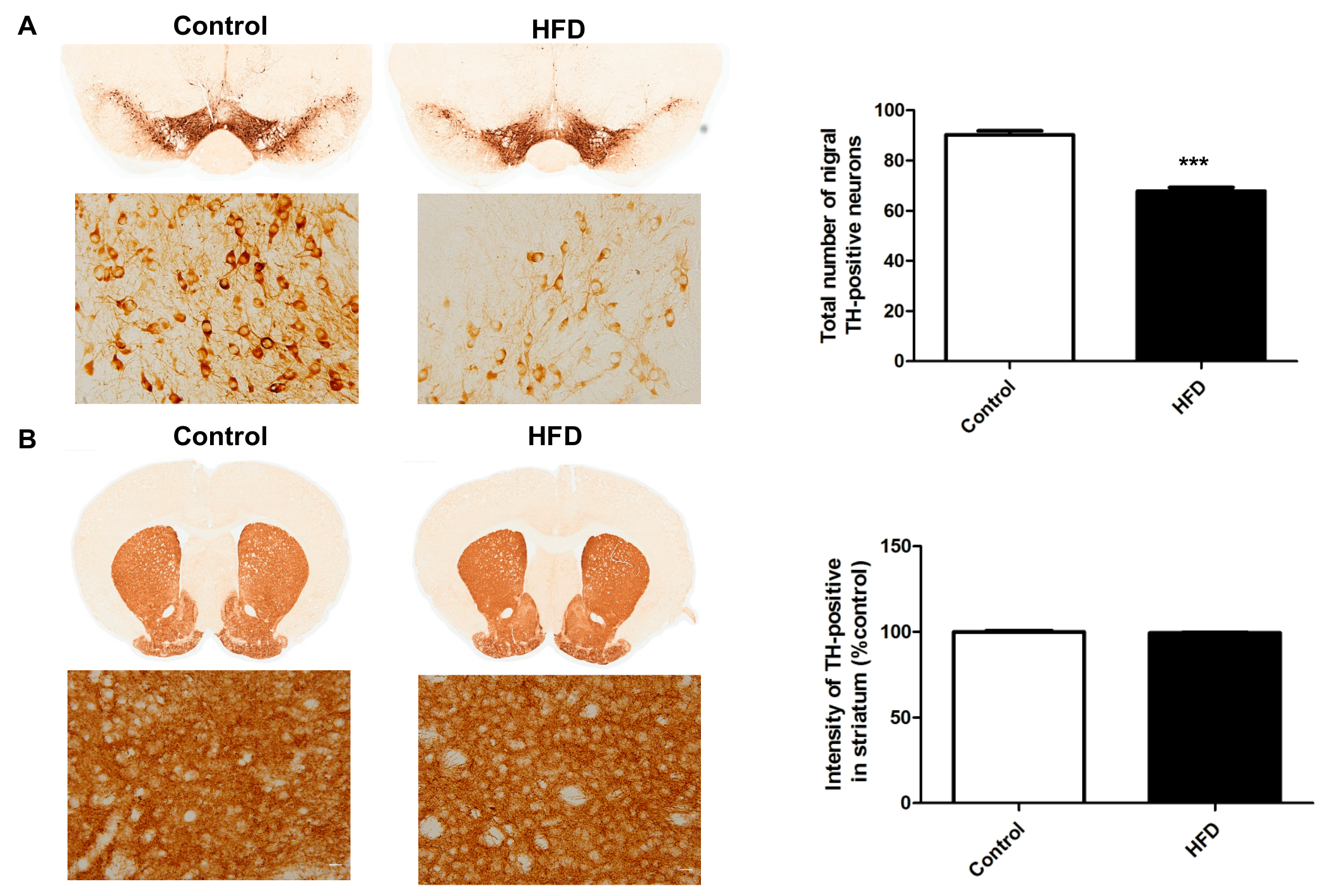 substantia nigra mouse