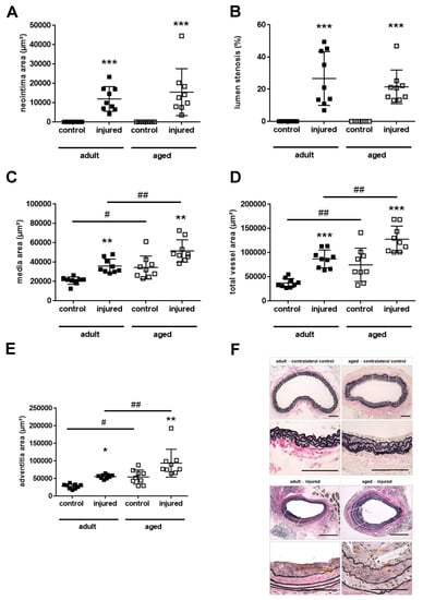 IJMS | Free Full-Text | Age-Dependent And -Independent Effects Of ...