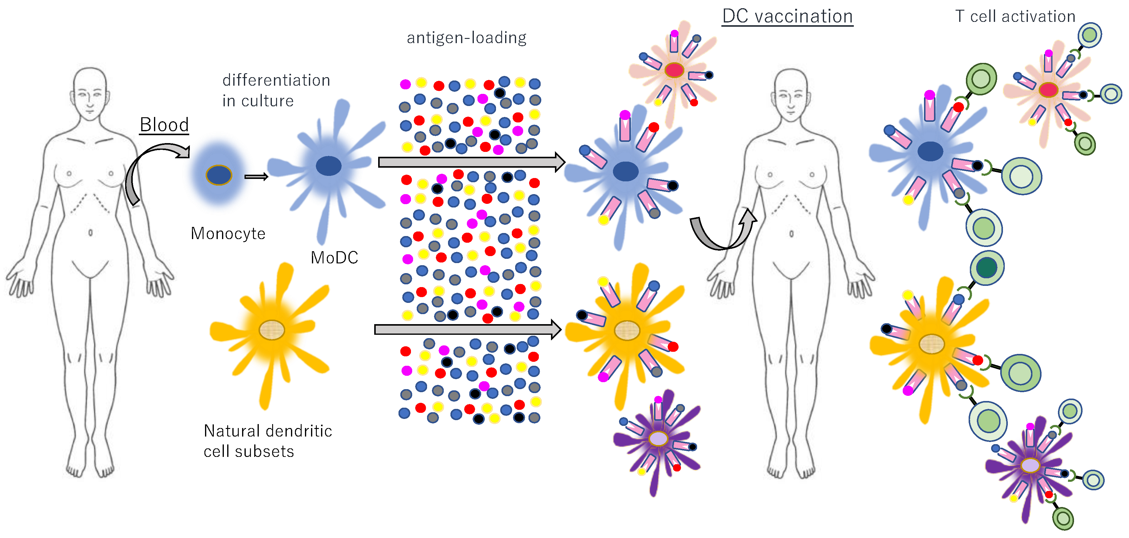 IJMS | Free Full-Text | Immunosurveillance and Immunoediting of Lung