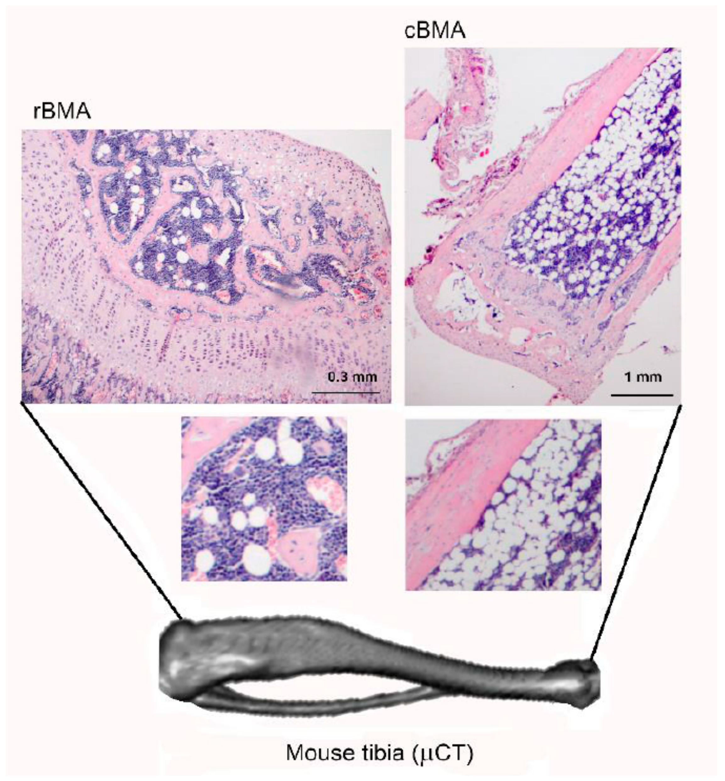 IJMS | Free Full-Text | Leptin, Adiponectin, and Sam68 in Bone Metastasis  from Breast Cancer