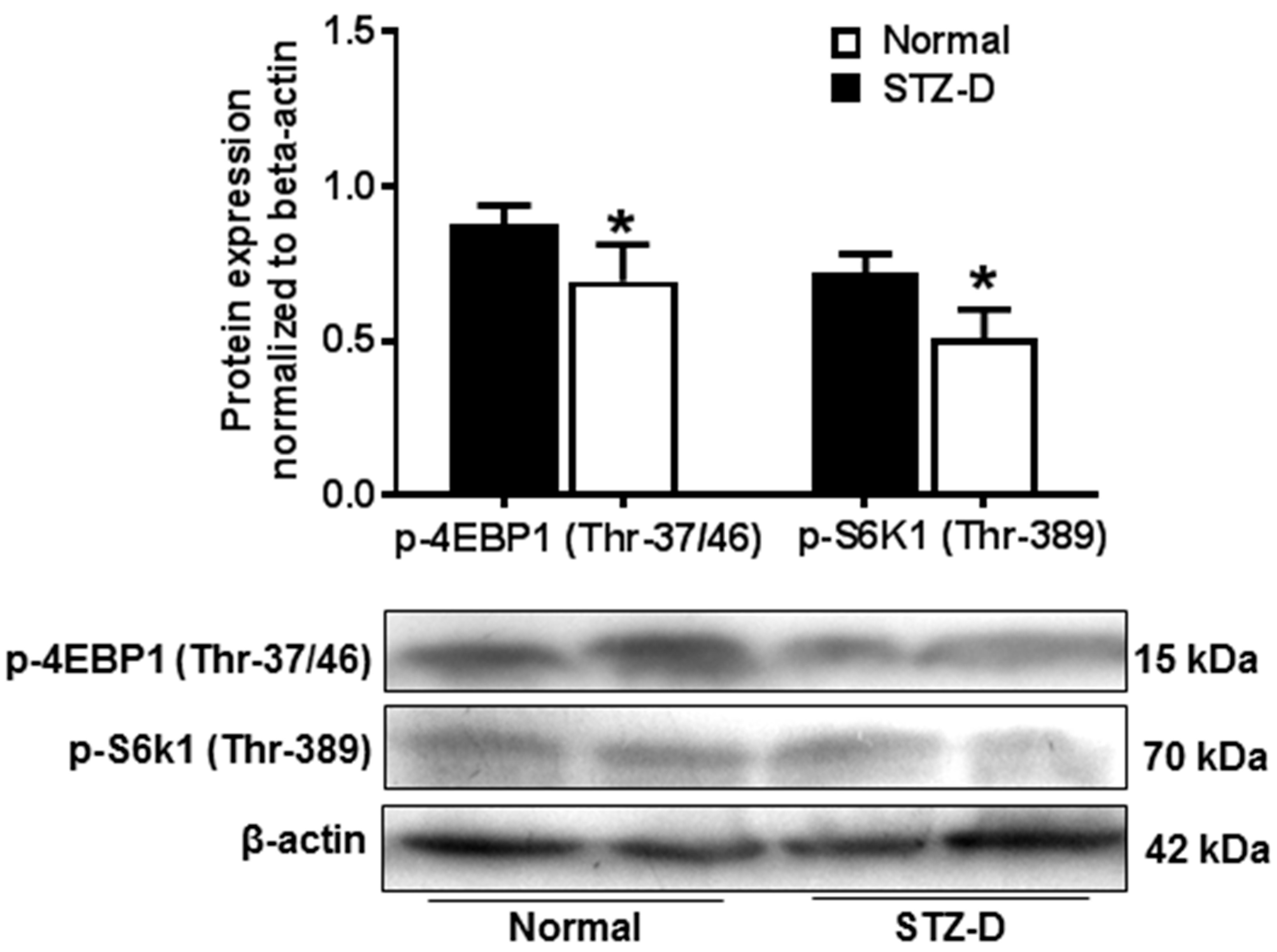 Ijms 21 01849 g003 Ijms 21 01849 g003