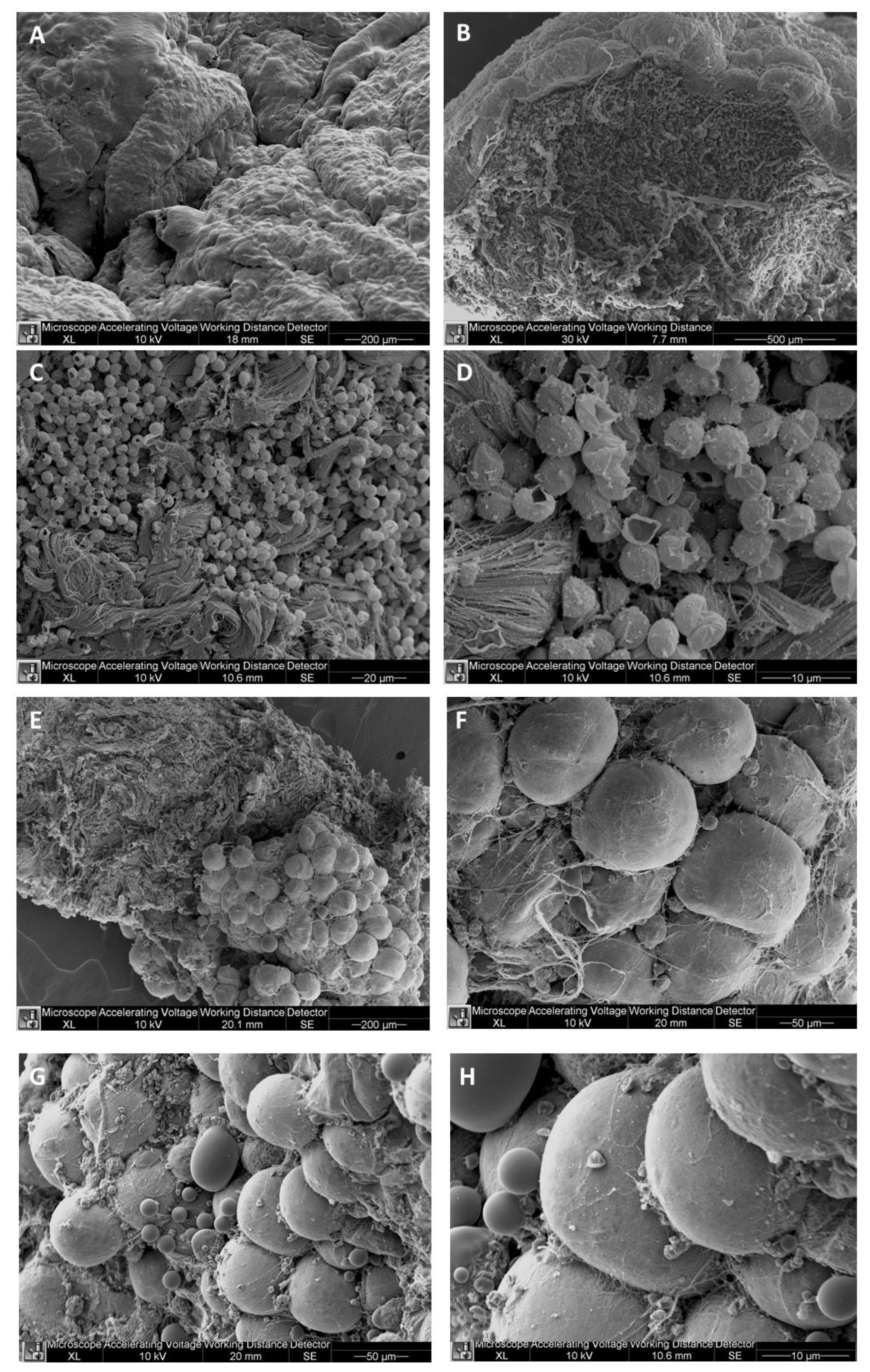 cellulite physiology