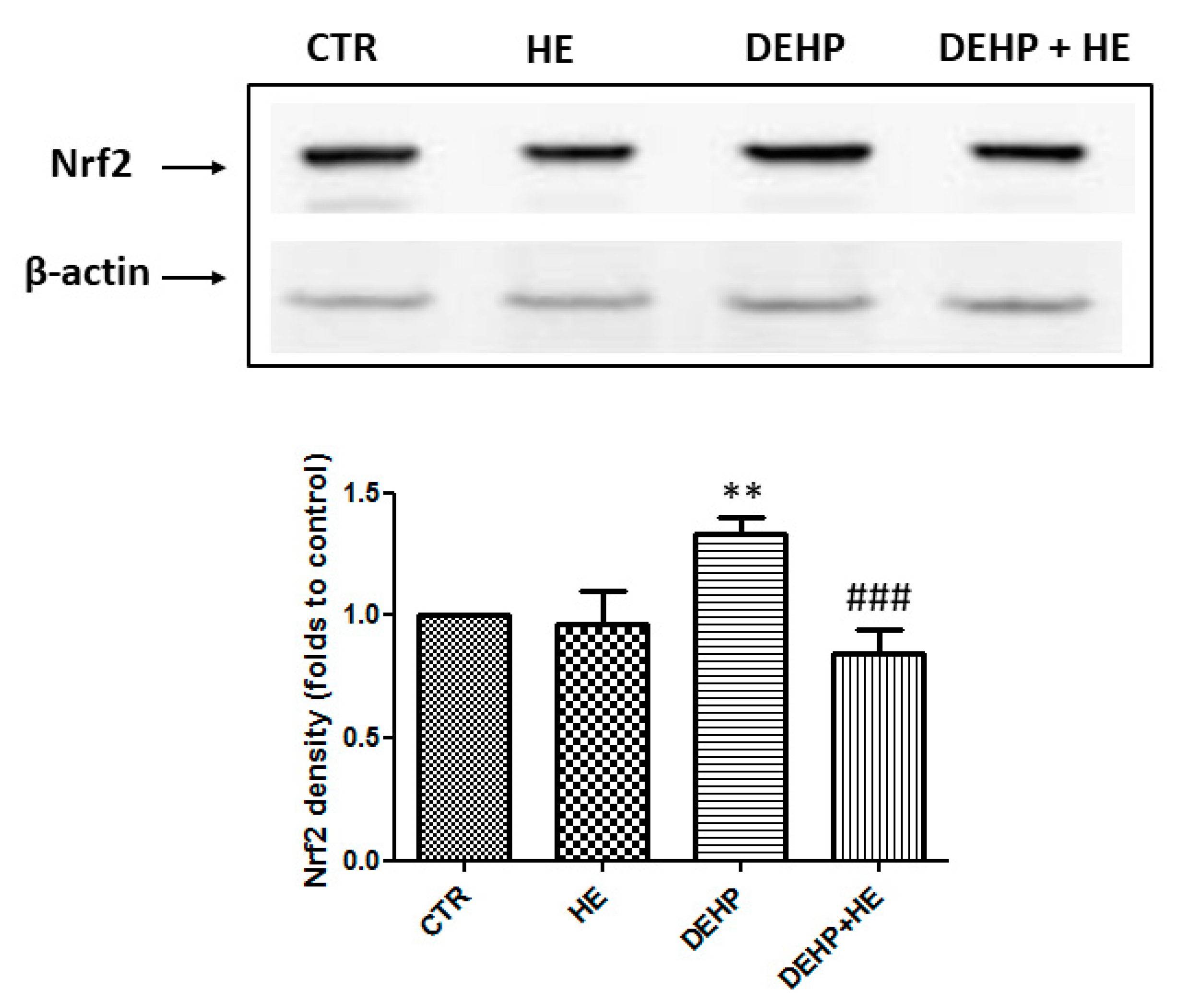 Ijms 21 02138 g005 Ijms 21 02138 g005