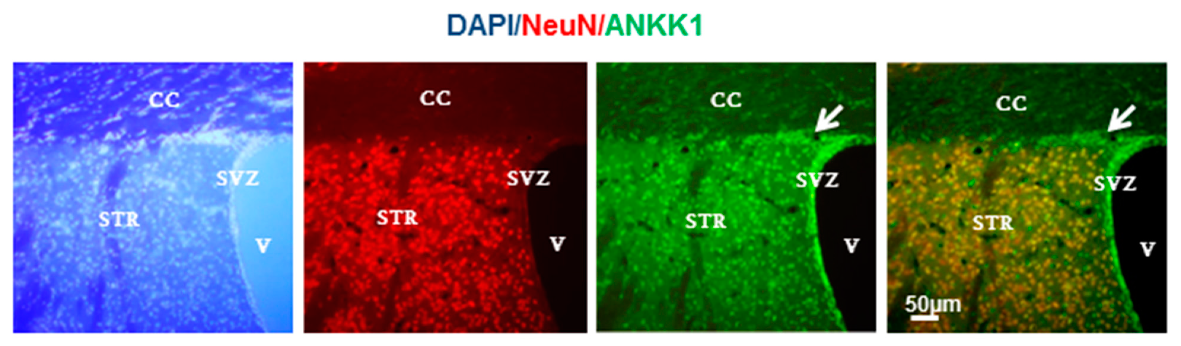 Ijms 21 02516 g003 Ijms 21 02516 g003