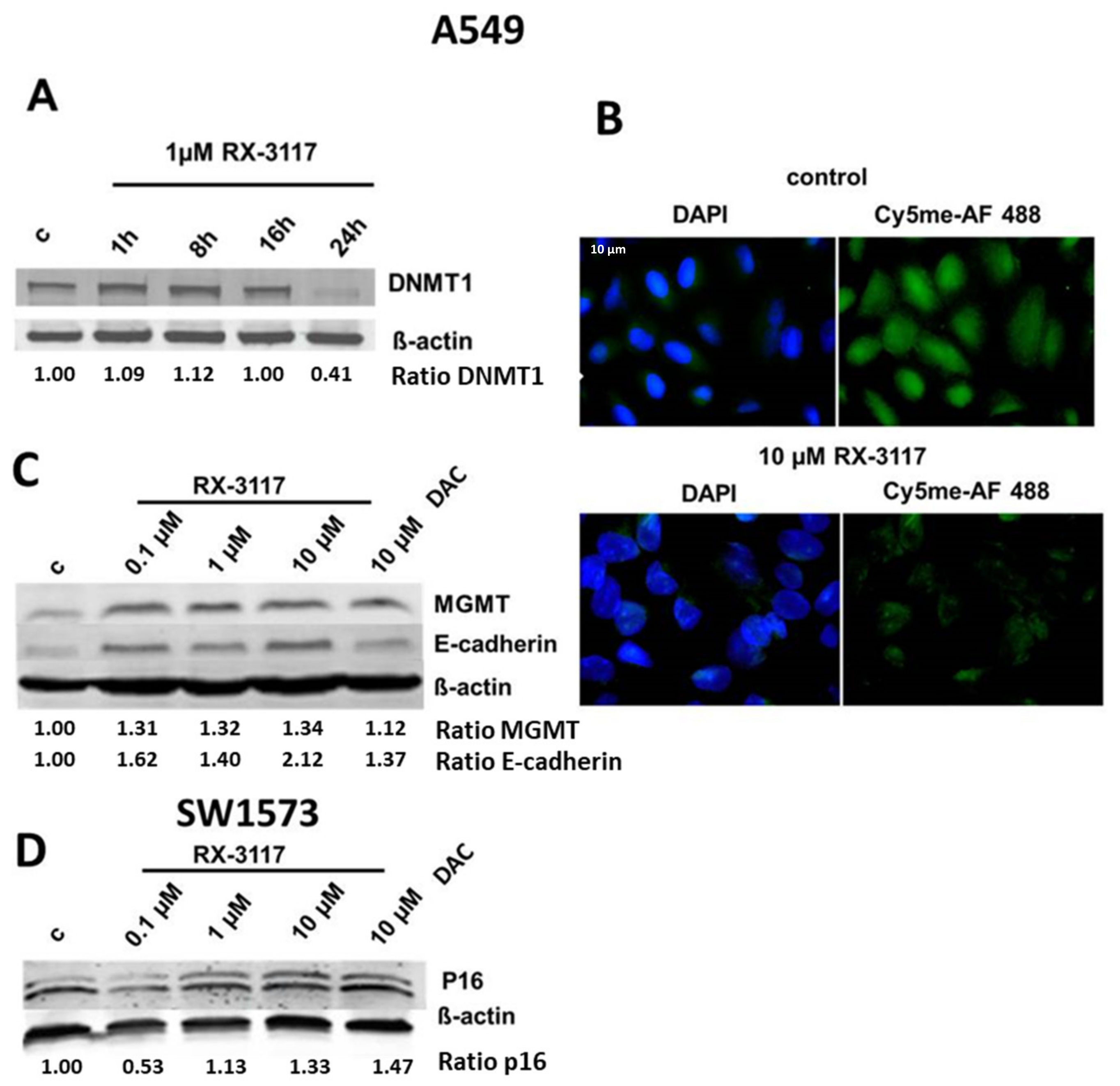 Ijms Free Full Text Rx 3117 Fluorocyclopentenyl Cytosine Mediated Down Regulation Of Dna Methyltransferase 1 Leads To Protein Expression Of Tumor Suppressor Genes And Increased Functionality Of The Proton Coupled Folate Carrier Html