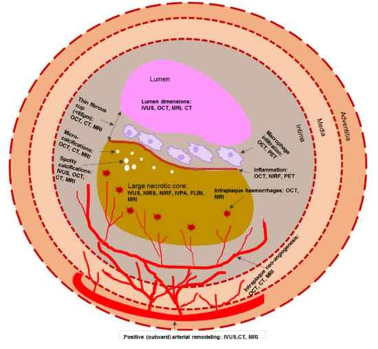 IJMS | Free Full-Text | Current Advances in the Diagnostic Imaging of ...