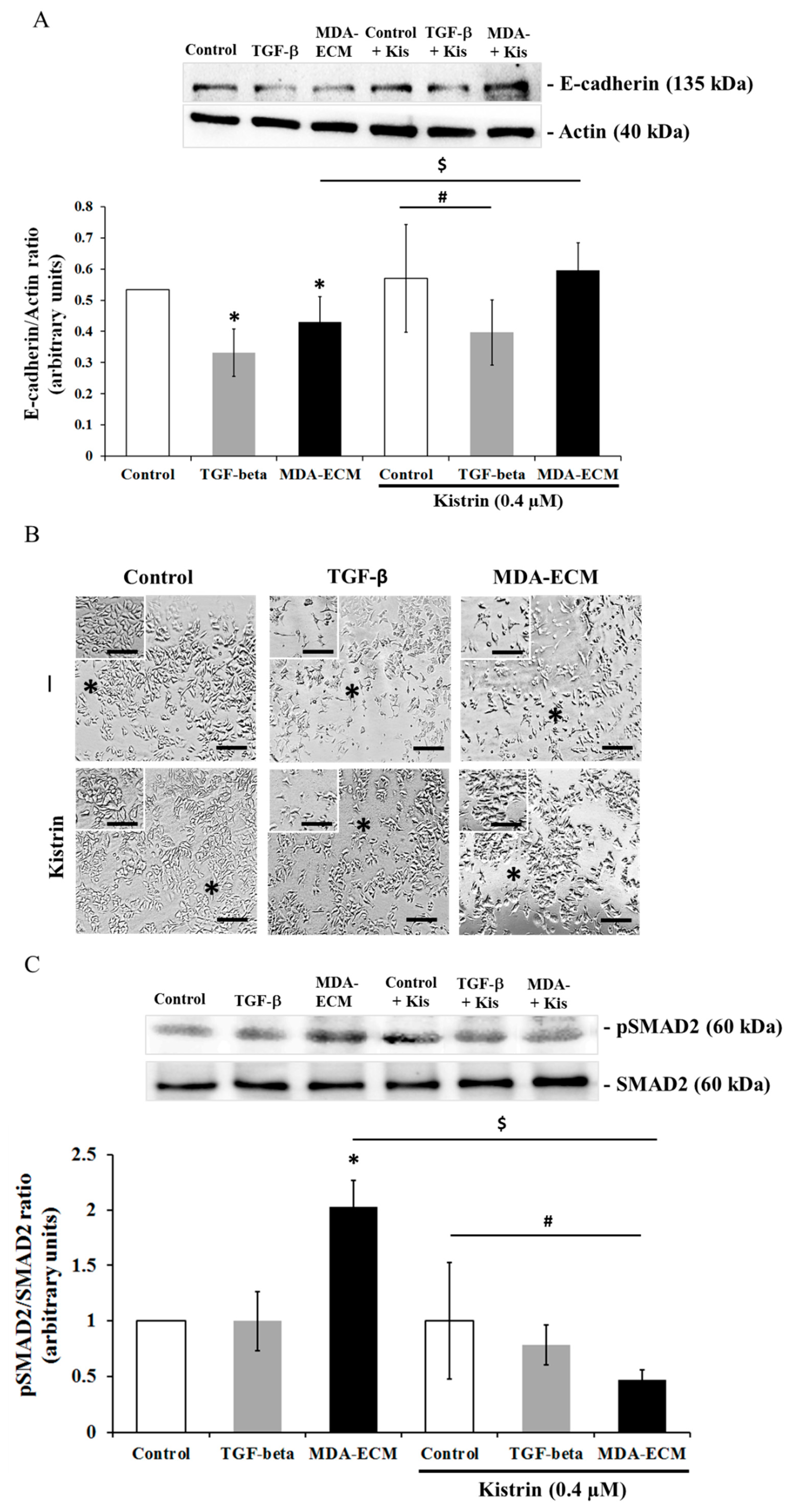 Ijms Free Full Text Extracellular Matrix Derived From High Metastatic Human Breast Cancer Triggers Epithelial Mesenchymal Transition In Epithelial Breast Cancer Cells Through Avb3 Integrin Html