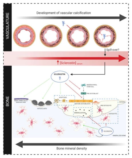 IJMS | Free Full-Text | The Role of Sclerostin in Bone and Ectopic ...