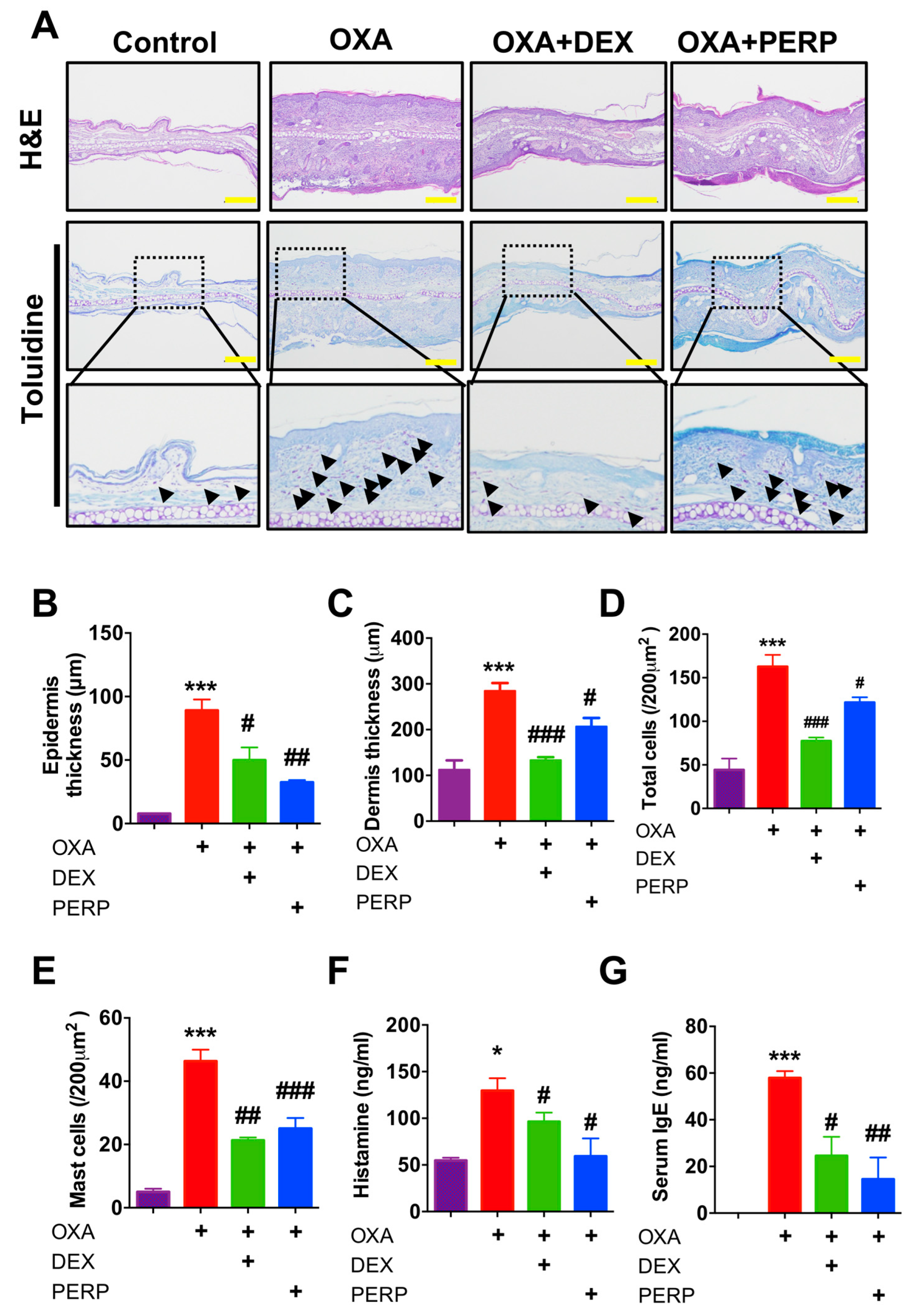 Ijms 21 03241 g004 Ijms 21 03241 g004