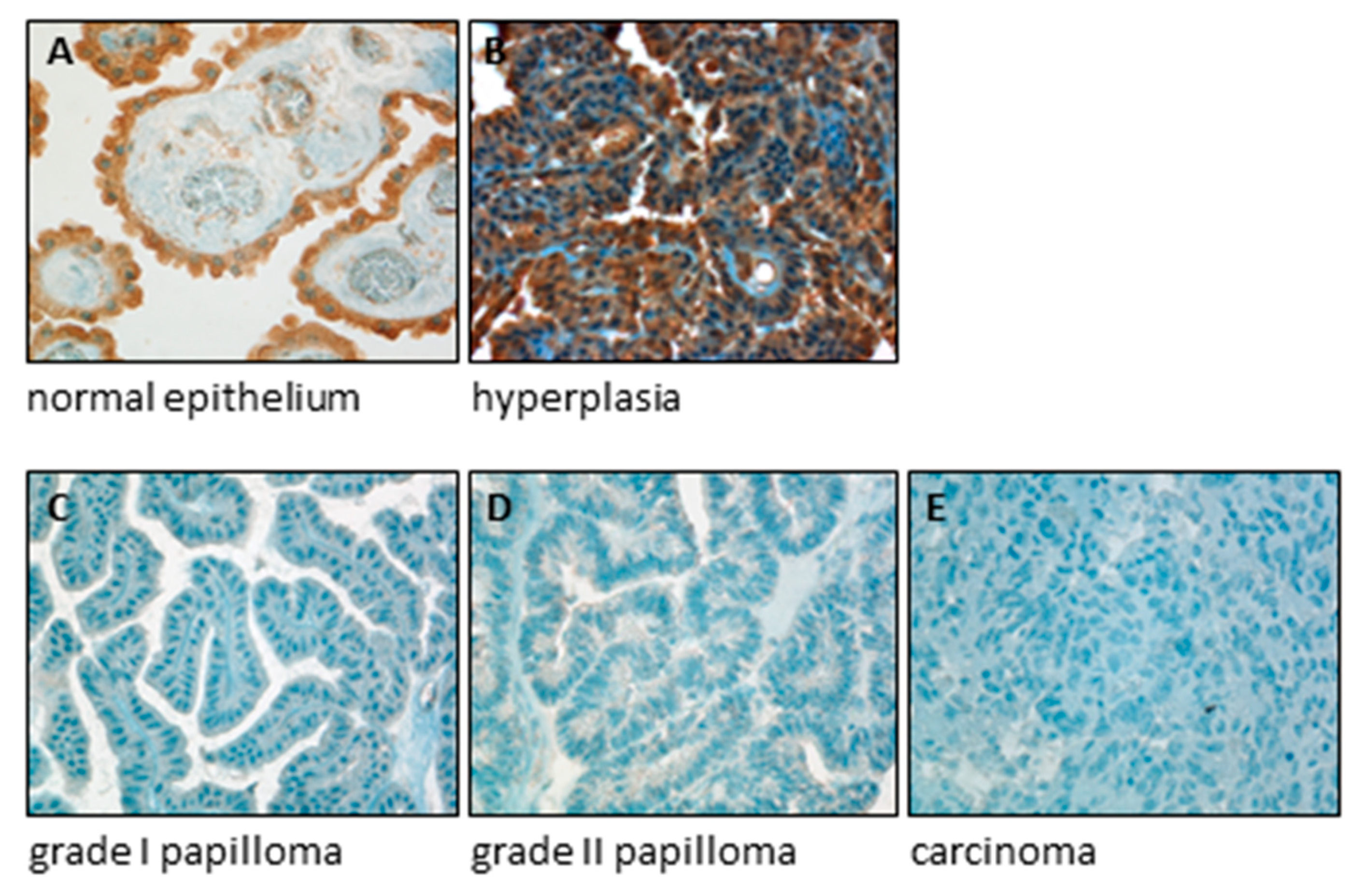 IJMS | Free Full-Text | Endoplasmic Reticulum Calcium Pumps and Tumor Cell  Differentiation | HTML