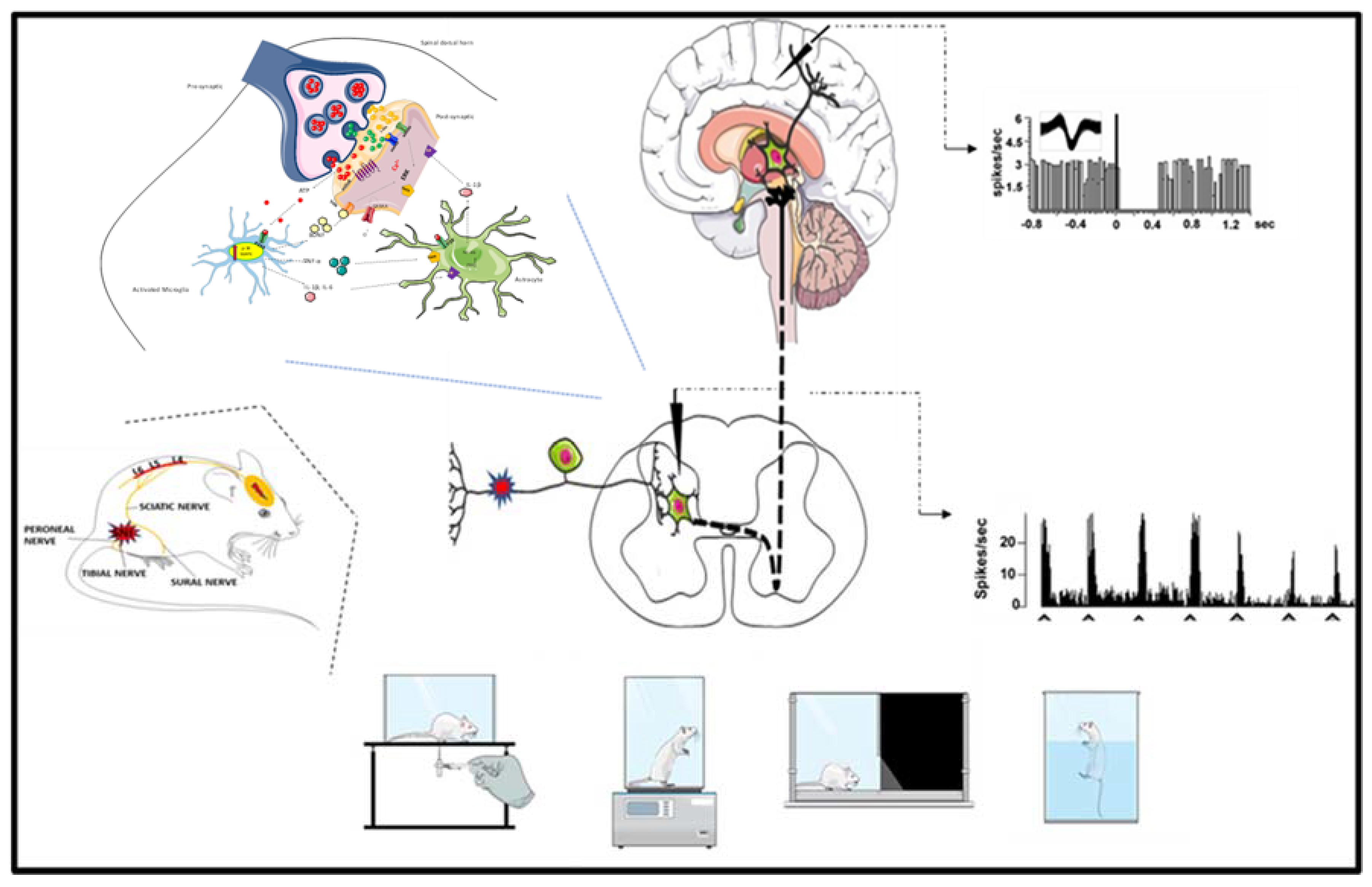 IJMS | Free Full-Text | Behavioral, Biochemical and Electrophysiological  Changes in Spared Nerve Injury Model of Neuropathic Pain