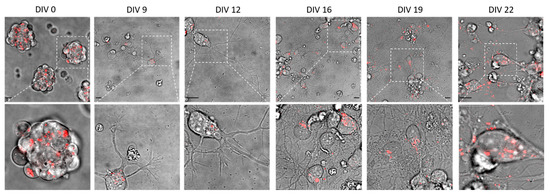 IJMS | Special Issue : Biogenesis and Functional Roles of Lysosomes