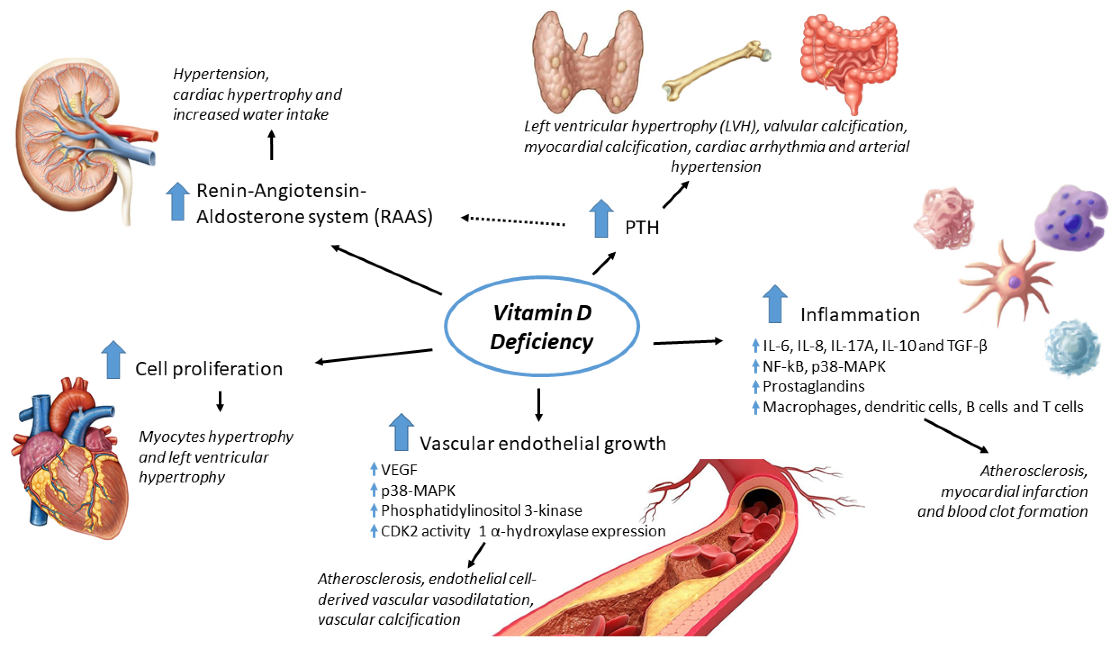 IJMS | Free Full-Text | Vitamin D and Cardiovascular Risk: Which  Implications in Children?