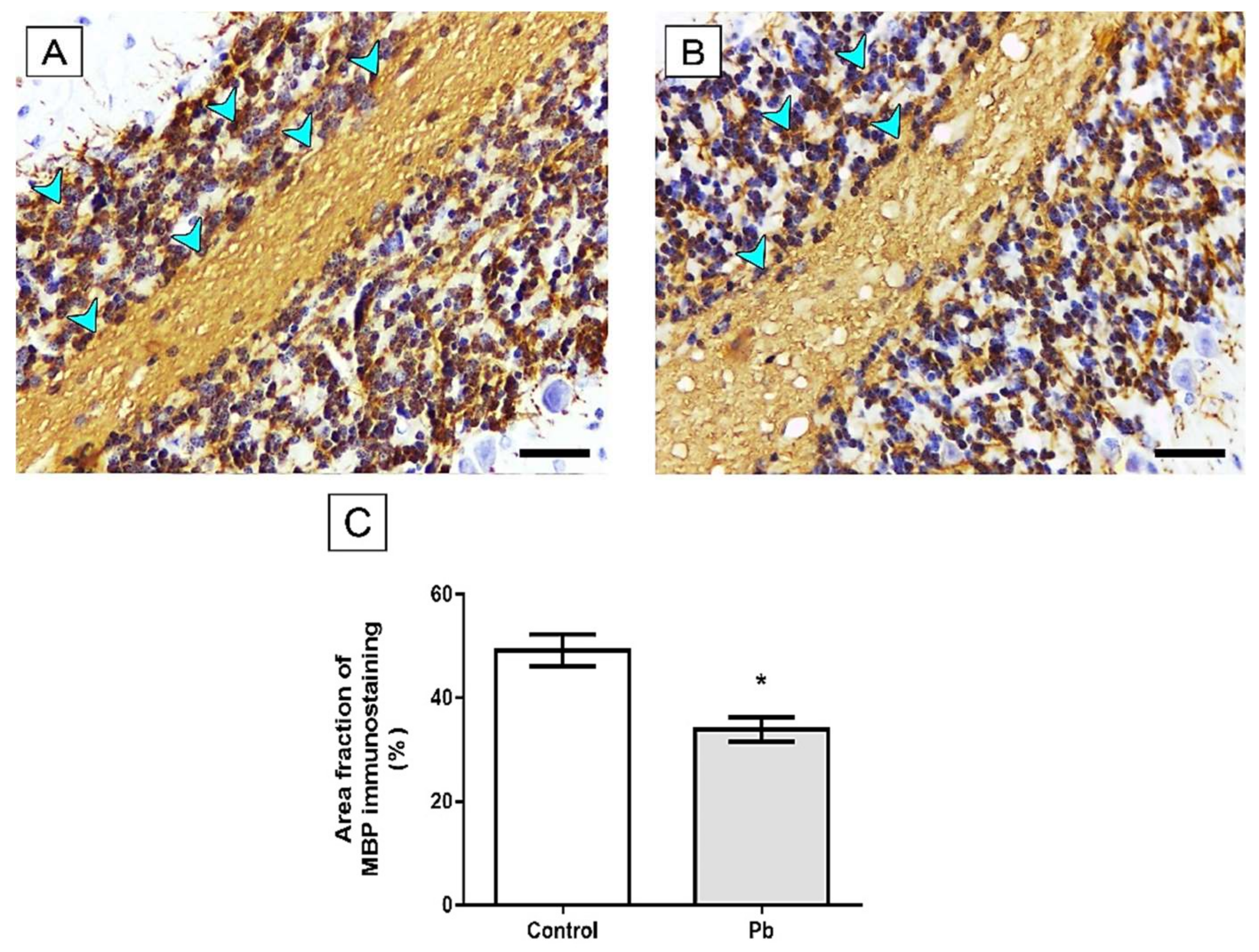Ijms 21 03571 g006 Ijms 21 03571 g006