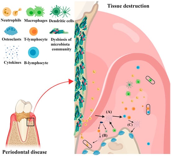 Ijms Free Full Text An Evidence Based Update On The Molecular Mechanisms Underlying Periodontal Diseases Html