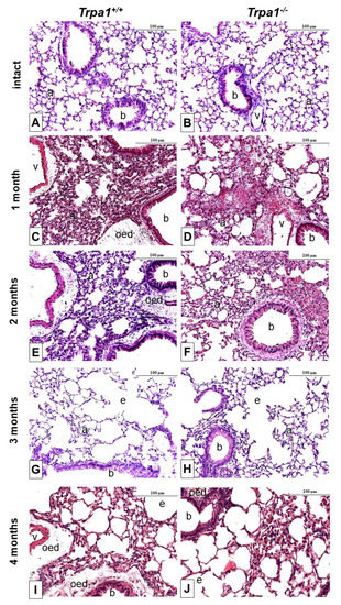 Ijms Free Full Text Complex Regulatory Role Of The Trpa1 Receptor In Acute And Chronic Airway Inflammation Mouse Models Html