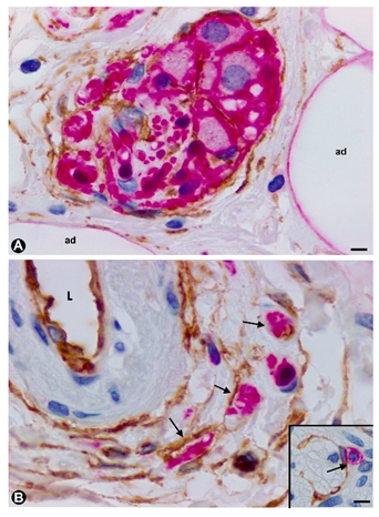 Ijms 21 04320 g004 Ijms 21 04320 g004