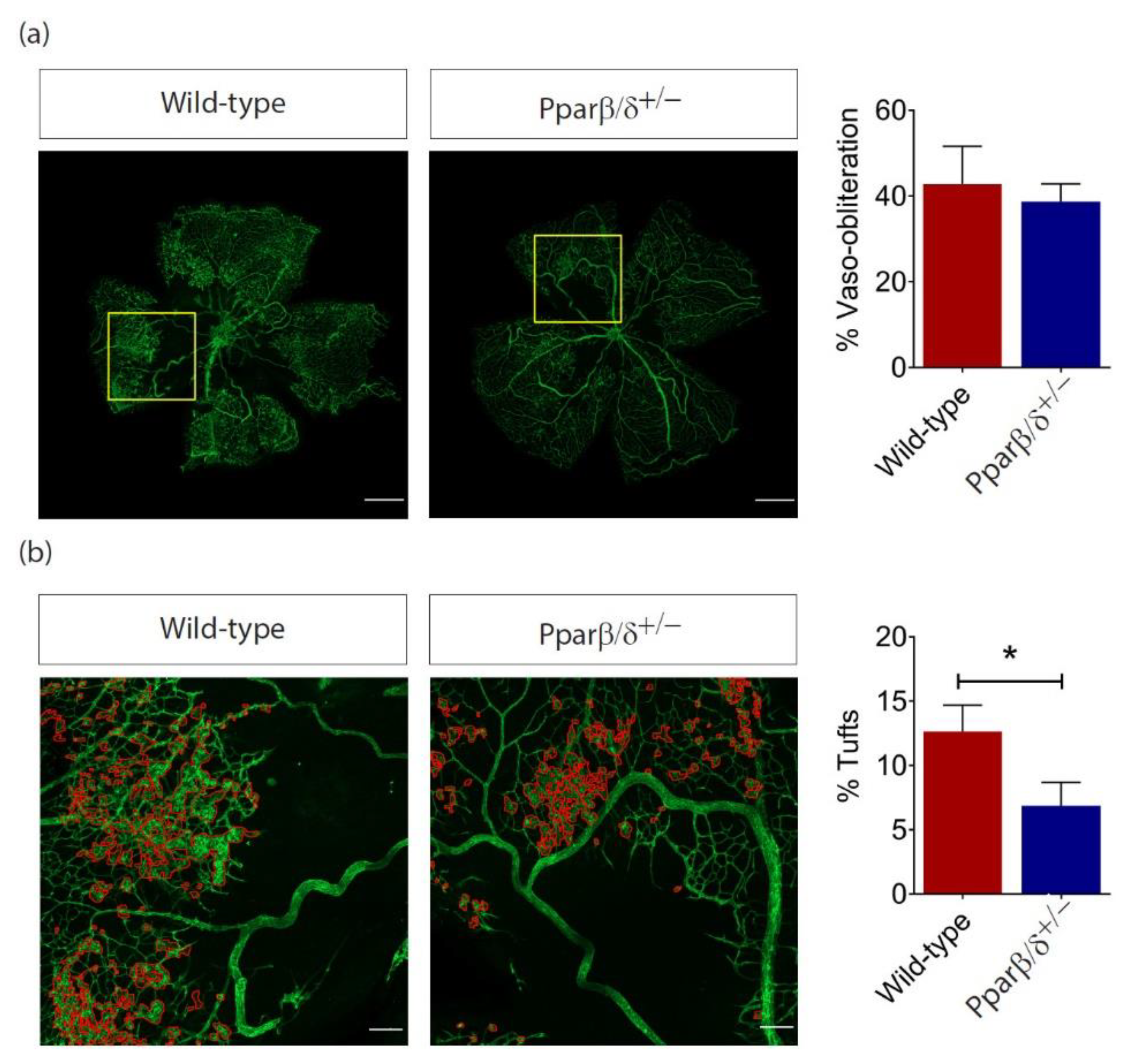 IJMS | Free Full-Text | Investigating the Role of PPARβ/δ in Retinal  Vascular Remodeling Using Pparβ/δ-Deficient Mice
