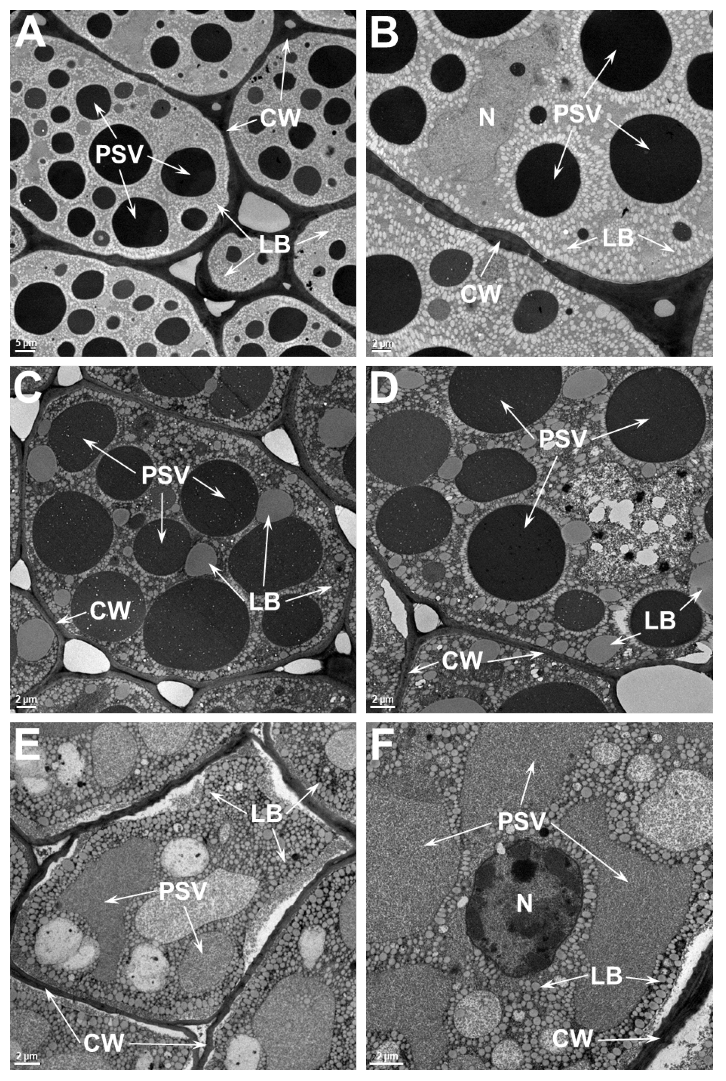 Ijms Free Full Text Effect Of Heat Stress On Seed Protein Composition And Ultrastructure Of Protein Storage Vacuoles In The Cotyledonary Parenchyma Cells Of Soybean Genotypes That Are Either Tolerant Or
