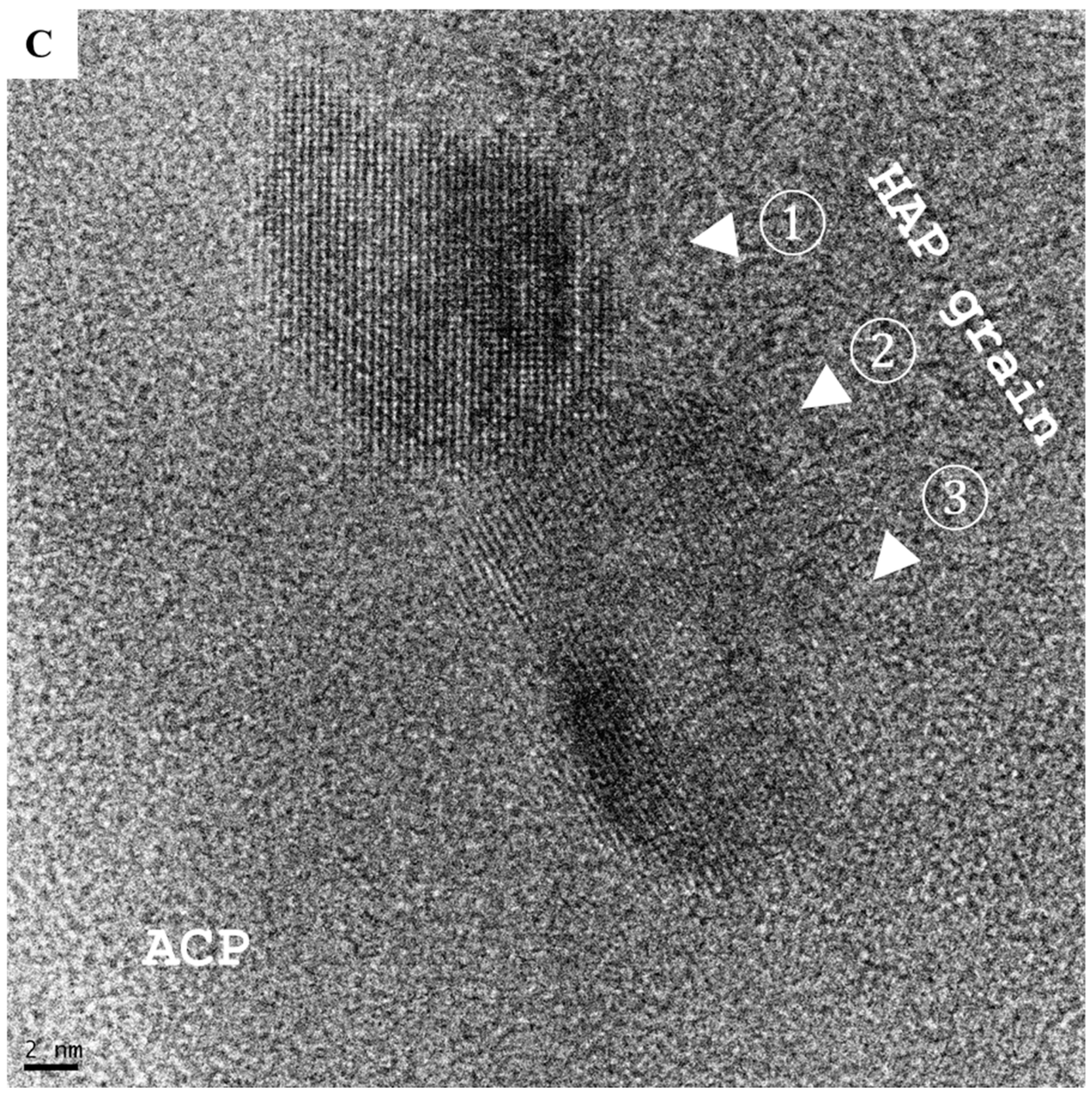 Ijms 21 04820 g005b Ijms 21 04820 g005b