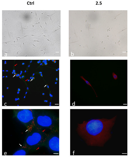 Ijms Free Full Text Rapha Myr A Blend Of Sulforaphane And Myrosinase Exerts Antitumor And Anoikis Sensitizing Effects On Human Astrocytoma Cells Modulating Sirtuins And Dna Methylation Html