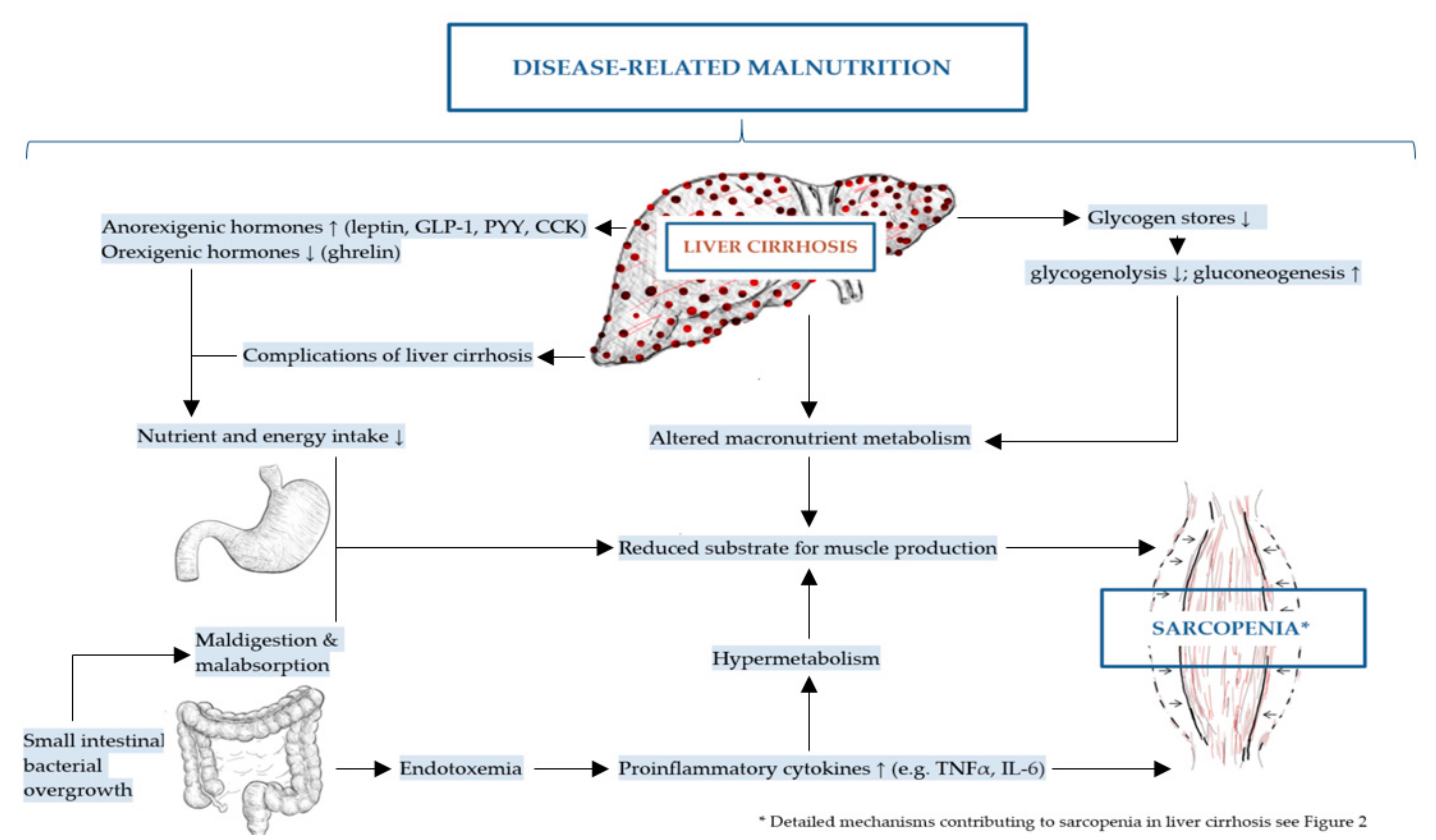 IJMS | Free Full-Text | Molecular Mechanism Contributing to Malnutrition  and Sarcopenia in Patients with Liver Cirrhosis | HTML
