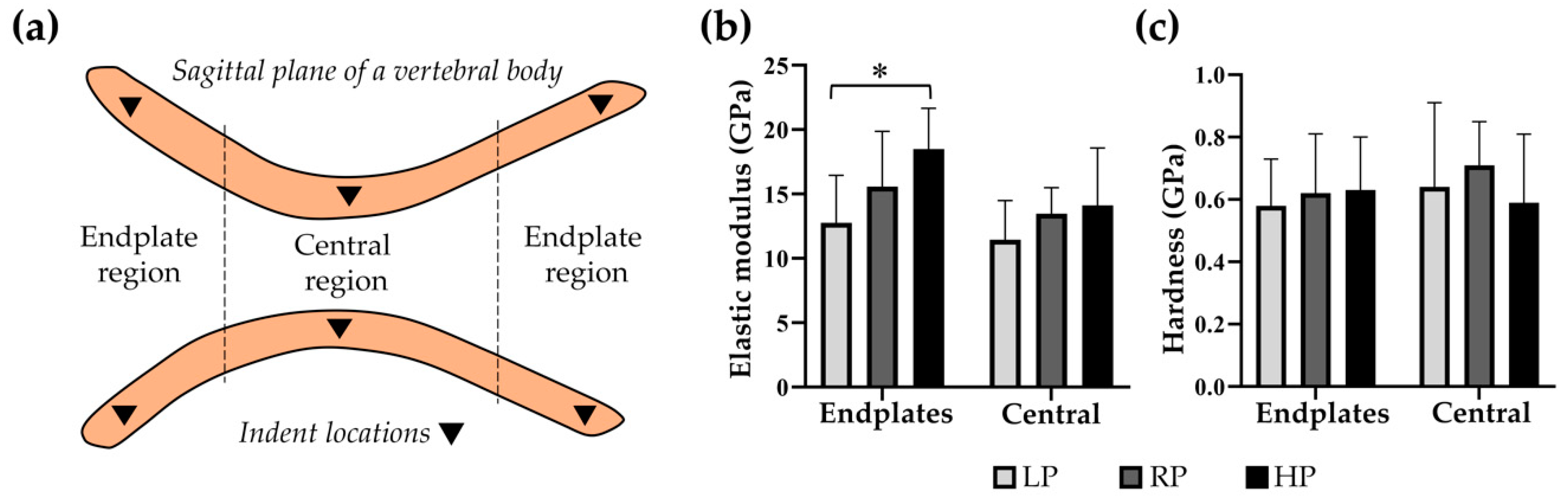 Ijms Free Full Text More Bone With Less Minerals The Effects Of Dietary Phosphorus On The Post Cranial Skeleton In Zebrafish Html