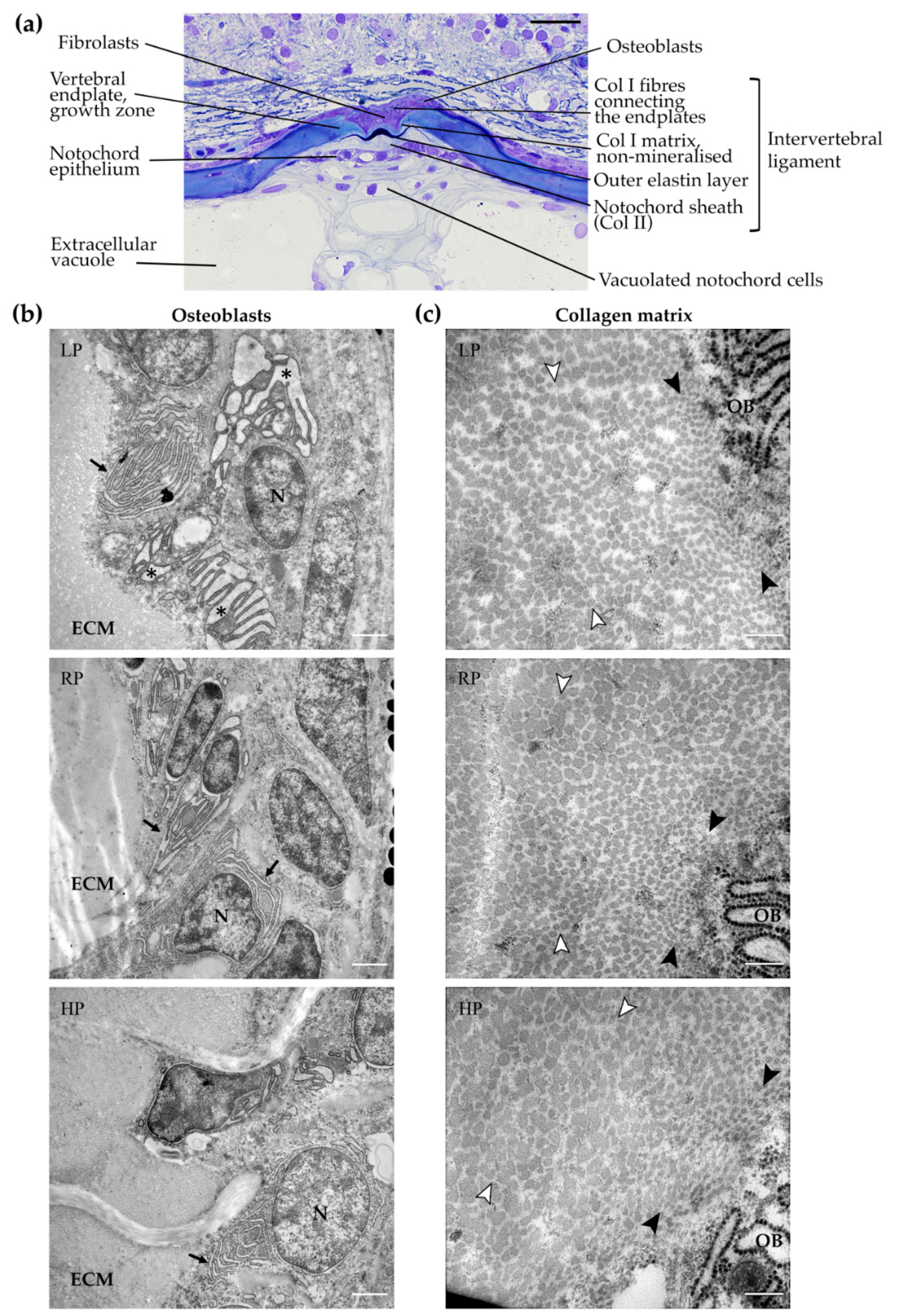 Ijms Free Full Text More Bone With Less Minerals The Effects Of Dietary Phosphorus On The Post Cranial Skeleton In Zebrafish Html