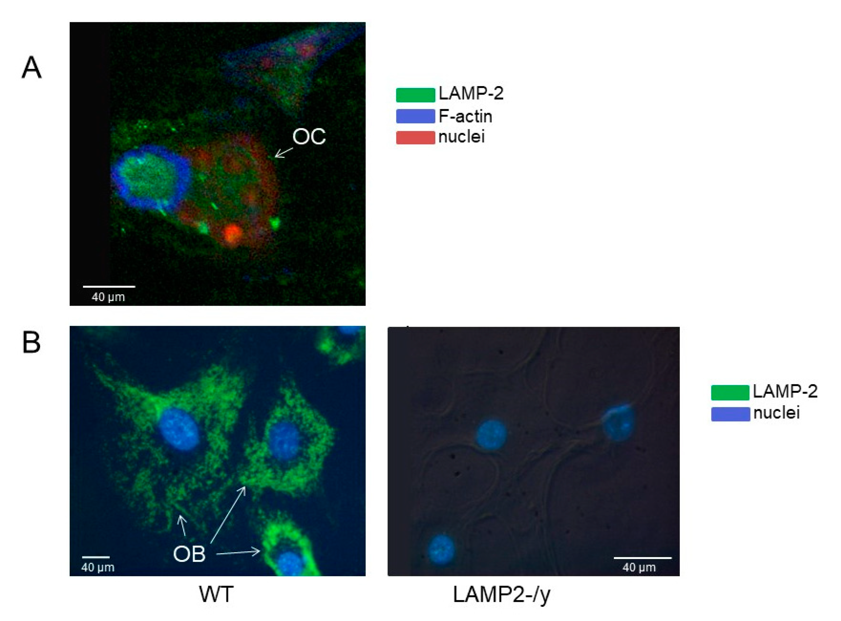 IJMS | Free Full-Text | LAMP-2 Is Involved in Surface Expression of RANKL  of Osteoblasts In Vitro